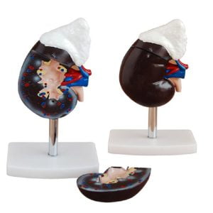 XC-BLS , XC-BLS Basic life support, BLS manikin (CPR & AED simulator) AED monitor, XC-101, XC-101 Life size skeleton (180 cm) with stand, XC-101 A, XC-101 A Skeleton (180 cm) Muscles & Ligaments, XC-101 E, XC-101 E Skeleton (180 cm) Flexible, XC-101 F, XC-101 F Flexible Skeleton with Ligaments, XC-102, XC-102 Skeleton (85 cm), XC-102 A, XC-102 A Skeleton (85 cm) with Spinal Nerves, XC-102 B, XC-102 B Skeleton (85 cm) with Spinal Nerves & Blood Vessel, XC-102 C, XC-102 C Skeleton (85 cm) with Painted Muscles, XC-102 CN, XC-102 CN Skeleton (85 cm) with Painted Muscles, XC-103, XC-103 Mini Skeleton, XC-104, XC-104 Life size Skull, XC-104 B, XC-104 B Life size Skull Painted, XC-104 C, XC-104 C Life size Skull colored bones, XC-104 D, XC-104 D Deluxe Life size Skull (Style D), XC-104 E, XC-104 E Skull with 8 parts Brain, XC-105, XC-105 Life size Vertebrae Column with Pelvis, XC-105 A, XC-105 A Vertebrae Column with Pelvis & Painted Muscles, XC-105 AN, XC-105 AN Vertebrae Column with Pelvis & Numbered Painted Muscles, XC-105 C, XC-105 C Didactic Flexible Vertebrae Column with Pelvis, XC-106, XC-106 Miniature Plastic Skull, XC-107, 3B Scientific Bangladesh, 3B Scientific dealer in Bangladesh, XC-107 Life size Vertebral column, XC-107 A, XC-107 A Vertebral column with painted muscles, XC-107 C, XC-107 C Didactic Vertebral column, XC-107 D, XC-107 D Vertebral column disarticulate model, XC-109, XC-109 Life size shoulder joint, XC-109 A, XC-109 A Life size muscled Shoulder joint, XC-110, XC-110 Life size Hip Joint, XC-111, XC-111 Life size Knee Joint, XC-112, XC-112 Life size Elbow Joint, XC-113, XC-113 Life size foot Joint, XC-113 A, XC-113 A Life size foot Joint with Ligaments, XC-114 Life size hand Joint, XC-114 A, XC-114 A Life size hand Joint with Ligaments, XC-115, XC-115 Life size pelvis with 5 pcs Lumber Vertebrae, XC-115 A, XC-115 A Half size pelvis with 5 pcs Lumber Vertebrae, XC-116, XC-116 Lumber set 2 Pcs, XC-117, XC-117 Lumber set 3 Pcs, XC-118, XC-118 Lumber set 4 Pcs, XC-119, XC-119 Life size lumber Vertebrae with sacrum & Coccyx & Herniated, XC-119 A, XC-119 A Mini Lumber Vertebrae with Sacrum & Coccyx & Herniated Disc, XC-120, XC-120 Thoracic Spinal Column, XC-121, XC-121 Life size Upper Extremity, XC-122, XC-122 Life size lower Extremity, XC-123, XC-123 Adult male Pelvis, XC-124, XC-124 Adult Female Pelvis, XC-125, XC-125 Female Pelvic Muscles & Organs, XC-126, XC-126 Life size vertebral clumn with pelvis & Femur head, XC-126A, XC-126A vertebral clumn with pelvis & Femur heads & Painted Muscies, XC-126AN, XC-126AN vertebral clumn with pelvis & Femur heads and numbered Painted Muscies, XC-126 C, XC-126 C Didactic vertebral clumn with pelvis & Femur head, XC-126 D, XC-126 D Flexible vertebral with removable Pelvis & Femur, XC-127, XC-127 Birth Demonstration, XC-128, XC-128 Life size pelvis with 2 Pcs Lumber Vertebrae, XC-130, XC-130 Disarticulated Skeleton with Skull, XC-133, XC-133 Cervical Vertebral Clumn with Nack Artery, XC-134, XC-134 Cutaway Osteoporosis, XC-135, XC-135 Skull with CervicalmSpine, XC-135 E, XC-135 E Skull with Brain and Cervical Spain 8 Parts, XC-201, XC-201 Male Torso (85 cm) 19 Parts, XC-202 A, XC-202 A Male Torso (42 cm) 13 Parts, XC-203, XC-203 Torso (26 cm) 15 Parts, XC-204, XC-204 Unisex Torso (85 cm) 23 Parts, XC-205, XC-205 Unisex Torso (45 cm) 23 Parts, XC-206, XC-206 Sexless Torso (85 cm) 20 Parts, XC-207, XC-207 Sexless Torso (42 cm) 18 Parts, XC-208, XC-208 Unisex Torso (85 cm) 40 Parts, XC-209, XC-209 Unisex Torso (85 cm) 20 Parts, XC-210, XC-210 Unisex Torso (85 cm) 30 Parts, XC-301, XC-301 Magnified Human Lartnx, XC-302, XC-302 Magnified Pulmonary Alveoli, XC-303 A, XC-303 A Giant Ear, XC-303 B, XC-303 B Middle Ear, XC-303 C, XC-303 C New Style Giant Ear, XC-303 D, XC-303 D Desktop Ear, XC-304, XC-304 Brain, XC-304 A, XC-304 A New Style Brain, XC-304 B, XC-304 B Brain, XC-305, XC-305 Expansion of Human Teeth, XC-306, XC-306 Stomach, XC-307, XC-307 Jumbo Heart, XC-307 A, XC-307 A Life size Heart, XC-307 B, XC-307 B New style life size heart, XC-307C, XC-307C New style Jumbo Heart, XC-307 D, XC-307 D Middle Heart, XC-308, XC-308 Brain with Arteries, XC-308 A, XC-308 A Brain with Arterial, XC-308 D, XC-308 D Brain with Arterial 9 Parts, XC-309, XC-309 Anatomy Nasal Cavity, XC-310-1, XC-310-1 Kidney, XC-310-2, XC-310-2 Kidney 2 Parts, XC-310-3, XC-310-3 Kidney with Adrenal Gland, XC-310-4, XC-310-4 Enlarged Kidney, XC-311, XC-311 Liver, Pancreas & Duodenum, XC-312, XC-312 Liver, XC-313, XC-313 Enlarge Skin, XC-313-2, XC-313-2 Skin Block, XC-313-3, XC-313-3 Skin Section, XC-315, XC-315 Digestive System, XC-316, XC-316 Giant Eye, XC-316 A, XC-316 A Giant Eye A, XC-316 B, XC-316 B Eye with Orbit, XC-317, XC-317 Expansion of Urinary Bladder, XC-318, XC-318 Brain with Arteries on Head, XC-318 B, XC-318 B Head with Brain, XC-319, XC-319 Median section of the Head, XC-319 A, XC-319 A Frontal Section & Median Section of the Head, XC-319 B, XC-319 B Frontal section of Head, XC-320, XC-320 Larynx, Heart & Lung, XC-321, XC-321 Lung, XC-321 B, XC-321 B Lung, XC-322, XC-322 Circulatory system, XC-324, XC-324 The Head, XC-325, XC-325 Plam Anatomy, XC-326, XC-326 Normal Flat & Arched Foot, XC-330, XC-330 Transparent Lung Segment, XC-331, XC-331 Male Urogenital system, XC-331 A, XC-331 A Human male Pelvis section Part 1, XC-331 B, XC-331 B Human male Pelvis section Part 2, XC-331 C, XC-331 C Advanced Male internal & external Gental Organs, XC-331 D, XC-331 D Male Gental Organ, XC-332, XC-332 Female Urogenital System, XC-332 A, XC-332 A Female Pelvis section 1 Part, XC-332 B, XC-332 B Female Pelvis section 4 Parts, XC-332 B-1, XC-332 B-1Female Pelvis section 2 Part2, XC-332 C, XC-332 C Advanced Female internal & external Gental Organ, XC-332 D, XC-332 D Female Pelvis, XC-333, XC-333 Urinary system, XC-334, XC-334 Human (80 cm) Muscles Male (27 Parts), XC-335, XC-335 Human Muscles 50 cm 1 Part, XC-336, XC-336 Muscles of human Arm 7 parts, XC-337, XC-337 Muscles of Lower Limb 13 Parts, XC-338, XC-338 Life size human Muscle foot (7 parts), XC-401, XC 401Multifunctional patient care Manikin, XC-401 A, XC-401 A High quality Nurse Trainning Doll (Male), XC-401 A-1, XC-401 A-1 New style High quality Nurse Trainning Doll (Male), XC-401 A-2, XC-401 A-2 Advanced Nurse Trainning Doll (with BP Trainning Arm Male), XC-401 B, XC-401 B High quality Nurse Trainning Doll (Female), XC-401 B-1, XC-401 B-1 New style High quality Nurse Trainning Doll (Female), XC-401 B-2, XC-401 B-2 Advanced Nurse trainning doll (with BP Trainning Arm Female), XC-401 C, XC-401 C Advanced Multifunctional Nursing Trainning Doll, XC-401 D, XC-401 D Advanced Trauma Simulator, XC-401 D-1, XC-401 D-1 Advance Trauma Accessories, XC-401 M, XC-401 M Multifunctional patient care Manikin (Male), XC-402, XC-402 Course of delivery, XC-402 A, XC-402 A Advanced Course of delivery, XC-402 A-1, XC-402 A-1 Delivery Machine, XC-403, XC-403 Dental Care (28 teeth), XC-403 A, XC-403 A Dental Care (32 teeth), XC-403 B, XC-403 B Small Dental Care (28 teeth), XC-403 C, XC-403 C Small Dental Care (32 teeth), XC-403 D, XC-403 D Dental Care with Cheek, XC-404, XC-404 Basic CPR Trainning (half Body), XC-404 A, XC-404 A Half body CPR Trainninf (male), XC-404 B, XC-404 B Half body CPR Trainninf (Female), XC-405, XC-405 Nurse Basic Practice Teaching 5 parts, XC-405 A, XC-405 A Simple male Urethral catheterization simulator, XC-405 B, XC-405 B Simple Female Urethral catheterization simulator, XC-405-2, XC-405-2 Transparent gastric lavage model, XC-406-1, XC-406-1 Whole body basic CPR Manikin style 100 (Male/Female), XC-406-2, XC-406-2 Whole body basic CPR Manikin style 200 (Male/Female), XC-406-5, XC-406-5 Whole body basic CPR Manikin style 500 (Male/Female), XC-406-5 Plus, XC-406-5 Plus New style CPR Trainning Manikin, XC-406A 5 Plus, XC-406A 5 Plus Whole advanced CPR Manikin style 500 (Female), XC-407, XC-407 Human Trachea Intubation, XC-407 A, XC-407 A Advanced Human Trachea Intubation, XC-408, XC-408 Electronic Urinary, XC-408 C, XC-408 C Advanced male Urethral Catheterization simulator, XC-408 D, XC-408 D Advanced female Urethral Catheterization simulator, XC-408 E, XC-408 E Transparant male Urethral Catheterization simulator, XC-408 F, XC-408 F Transparent female Urethral Catheterization simulator, XC-409, XC-409 New Born baby, XC-409 A, XC-409 A New style New Born baby, XC-409A-1, XC-409A-1 New style New Born baby model (Girl), XC-409 B, XC-409 B Advanced New Born care, XC-409 C, XC-409 C Advanced neonate Umbilical cord, XC-409 C-1, XC-409 C-1 Umbilical Cord, XC-409 D, XC-409 D Tracheostomy care infant, XC-409 E, XC-409 E Neonate scalp venipuncture, XC-410, XC-410 New born Intubation, XC-410 A, XC-410 A Infant Intubation trainning, XC-411, XC-411 Gynecological Trainning simulator, XC-412, XC-412 Advanced maternity, XC-414, XC-414 Development process for ferus, XC-414 A, XC-414 A The development process for ferus (half size), XC-416, XC-416 New born CPR Trainning manikin, XC-417, XC-417 Conception Guidance, XC-417 A, XC-417 A Female Contraception Guidance, XC-417 B, XC-417 B Male Condom Simulator (Transparent Base), XC-418, XC-418 Breast Examination, XC-418 B, XC-418 B Lactation Trainning model, Xincheng Scientific Industries Co., Ltd, Xincheng Scientific Model, Xincheng Scientific Human model, Xincheng Scientific Human body models, Models, Charts, Human body charts, China Models, China Chart, XC-BLS price in bd, XC-BLS Basic life support price in bd, BLS manikin (CPR & AED simulator) AED monitor price in bd, XC-101 price in bd, XC-101 Life size skeleton (180 cm) with stand price in bd, XC-101 A price in bd, XC-101 A Skeleton (180 cm) Muscles & Ligaments price in bd, XC-101 E price in bd, XC-101 E Skeleton (180 cm) Flexible price in bd, XC-101 F price in bd, XC-101 F Flexible Skeleton with Ligaments price in bd, XC-102 price in bd, XC-102 Skeleton (85 cm) price in bd, XC-102 A price in bd, XC-102 A Skeleton (85 cm) with Spinal Nerves price in bd, XC-102 B price in bd, XC-102 B Skeleton (85 cm) with Spinal Nerves & Blood Vessel price in bd, XC-102 C price in bd, XC-102 C Skeleton (85 cm) with Painted Muscles price in bd, XC-102 CN price in bd, XC-102 CN Skeleton (85 cm) with Painted Muscles price in bd, XC-103 price in bd, XC-103 Mini Skeleton price in bd, XC-104 price in bd, XC-104 Life size Skull price in bd, XC-104 B price in bd, XC-104 B Life size Skull Painted price in bd, XC-104 C price in bd, XC-104 C Life size Skull colored bones price in bd, XC-104 D price in bd, XC-104 D Deluxe Life size Skull (Style D) price in bd, XC-104 E price in bd, XC-104 E Skull with 8 parts Brain price in bd, XC-105 price in bd, XC-105 Life size Vertebrae Column with Pelvis price in bd, XC-105 A price in bd, XC-105 A Vertebrae Column with Pelvis & Painted Muscles price in bd, XC-105 AN price in bd, XC-105 AN Vertebrae Column with Pelvis & Numbered Painted Muscles price in bd, XC-105 C price in bd, XC-105 C Didactic Flexible Vertebrae Column with Pelvis price in bd, XC-106 price in bd, XC-106 Miniature Plastic Skull price in bd, XC-107 price in bd, XC-107 Life size Vertebral column price in bd, XC-107 A price in bd, XC-107 A Vertebral column with painted muscles price in bd, XC-107 C price in bd, XC-107 C Didactic Vertebral column price in bd, XC-107 D price in bd, XC-107 D Vertebral column disarticulate model price in bd, XC-109 price in bd, XC-109 Life size shoulder joint price in bd, XC-109 A price in bd, XC-109 A Life size muscled Shoulder joint price in bd, XC-110 price in bd, XC-110 Life size Hip Joint price in bd, XC-111 price in bd, XC-111 Life size Knee Joint price in bd, XC-112 price in bd, XC-112 Life size Elbow Joint price in bd, XC-113 price in bd, XC-113 Life size foot Joint price in bd, XC-113 A price in bd, XC-113 A Life size foot Joint with Ligaments price in bd, XC-114 Life size hand Joint price in bd, XC-114 A price in bd, XC-114 A Life size hand Joint with Ligaments price in bd, XC-115 price in bd, XC-115 Life size pelvis with 5 pcs Lumber Vertebrae price in bd, XC-115 A price in bd, XC-115 A Half size pelvis with 5 pcs Lumber Vertebrae price in bd, XC-116 price in bd, XC-116 Lumber set 2 Pcs price in bd, XC-117 price in bd, XC-117 Lumber set 3 Pcs price in bd, XC-118 price in bd, XC-118 Lumber set 4 Pcs price in bd, XC-119 price in bd, XC-119 Life size lumber Vertebrae with sacrum & Coccyx & Herniated price in bd, XC-119 A price in bd, XC-119 A Mini Lumber Vertebrae with Sacrum & Coccyx & Herniated Disc price in bd, XC-120 price in bd, XC-120 Thoracic Spinal Column price in bd, XC-121 price in bd, XC-121 Life size Upper Extremity price in bd, XC-122 price in bd, XC-122 Life size lower Extremity price in bd, XC-123 price in bd, XC-123 Adult male Pelvis price in bd, XC-124 price in bd, XC-124 Adult Female Pelvis price in bd, XC-125 price in bd, XC-125 Female Pelvic Muscles & Organs price in bd, XC-126 price in bd, XC-126 Life size vertebral clumn with pelvis & Femur head price in bd, XC-126A price in bd, XC-126A vertebral clumn with pelvis & Femur heads & Painted Muscies price in bd, XC-126AN price in bd, XC-126AN vertebral clumn with pelvis & Femur heads and numbered Painted Muscies price in bd, XC-126 C price in bd, XC-126 C Didactic vertebral clumn with pelvis & Femur head price in bd, XC-126 D price in bd, XC-126 D Flexible vertebral with removable Pelvis & Femur price in bd, XC-127 price in bd, XC-127 Birth Demonstration price in bd, XC-128 price in bd, XC-128 Life size pelvis with 2 Pcs Lumber Vertebrae price in bd, XC-130 price in bd, XC-130 Disarticulated Skeleton with Skull price in bd, XC-133 price in bd, XC-133 Cervical Vertebral Clumn with Nack Artery price in bd, XC-134 price in bd, XC-134 Cutaway Osteoporosis price in bd, XC-135 price in bd, XC-135 Skull with CervicalmSpine price in bd, XC-135 E price in bd, XC-135 E Skull with Brain and Cervical Spain 8 Parts price in bd, XC-201 price in bd, XC-201 Male Torso (85 cm) 19 Parts price in bd, XC-202 A price in bd, XC-202 A Male Torso (42 cm) 13 Parts price in bd, XC-203 price in bd, XC-203 Torso (26 cm) 15 Parts price in bd, XC-204 price in bd, XC-204 Unisex Torso (85 cm) 23 Parts price in bd, XC-205 price in bd, XC-205 Unisex Torso (45 cm) 23 Parts price in bd, XC-206 price in bd, XC-206 Sexless Torso (85 cm) 20 Parts price in bd, XC-207 price in bd, XC-207 Sexless Torso (42 cm) 18 Parts price in bd, XC-208 price in bd, XC-208 Unisex Torso (85 cm) 40 Parts price in bd, XC-209 price in bd, XC-209 Unisex Torso (85 cm) 20 Parts price in bd, XC-210 price in bd, XC-210 Unisex Torso (85 cm) 30 Parts price in bd, XC-301 price in bd, XC-301 Magnified Human Lartnx price in bd, XC-302 price in bd, XC-302 Magnified Pulmonary Alveoli price in bd, XC-303 A price in bd, XC-303 A Giant Ear price in bd, XC-303 B price in bd, XC-303 B Middle Ear price in bd, XC-303 C price in bd, XC-303 C New Style Giant Ear price in bd, XC-303 D price in bd, XC-303 D Desktop Ear price in bd, XC-304 price in bd, XC-304 Brain price in bd, XC-304 A price in bd, XC-304 A New Style Brain price in bd, XC-304 B price in bd, XC-304 B Brain price in bd, XC-305 price in bd, XC-305 Expansion of Human Teeth price in bd, XC-306 price in bd, XC-306 Stomach price in bd, XC-307 price in bd, XC-307 Jumbo Heart price in bd, XC-307 A price in bd, XC-307 A Life size Heart price in bd, XC-307 B price in bd, XC-307 B New style life size heart price in bd, XC-307C price in bd, XC-307C New style Jumbo Heart price in bd, XC-307 D price in bd, XC-307 D Middle Heart price in bd, XC-308 price in bd, XC-308 Brain with Arteries price in bd, XC-308 A price in bd, XC-308 A Brain with Arterial price in bd, XC-308 D price in bd, XC-308 D Brain with Arterial 9 Parts price in bd, XC-309 price in bd, XC-309 Anatomy Nasal Cavity price in bd, XC-310-1 price in bd, XC-310-1 Kidney price in bd, XC-310-2 price in bd, XC-310-2 Kidney 2 Parts price in bd, XC-310-3 price in bd, XC-310-3 Kidney with Adrenal Gland price in bd, XC-310-4 price in bd, XC-310-4 Enlarged Kidney price in bd, XC-311 price in bd, XC-311 Liver price in bd, Pancreas & Duodenum price in bd, XC-312 price in bd, XC-312 Liver price in bd, XC-313 price in bd, XC-313 Enlarge Skin price in bd, XC-313-2 price in bd, XC-313-2 Skin Block price in bd, XC-313-3 price in bd, XC-313-3 Skin Section price in bd, XC-315 price in bd, XC-315 Digestive System price in bd, XC-316 price in bd, XC-316 Giant Eye price in bd, XC-316 A price in bd, XC-316 A Giant Eye A price in bd, XC-316 B price in bd, XC-316 B Eye with Orbit price in bd, XC-317 price in bd, XC-317 Expansion of Urinary Bladder price in bd, XC-318 price in bd, XC-318 Brain with Arteries on Head price in bd, XC-318 B price in bd, XC-318 B Head with Brain price in bd, XC-319 price in bd, XC-319 Median section of the Head price in bd, XC-319 A price in bd, XC-319 A Frontal Section & Median Section of the Head price in bd, XC-319 B price in bd, XC-319 B Frontal section of Head price in bd, XC-320 price in bd, XC-320 Larynx price in bd, Heart & Lung price in bd, XC-321 price in bd, XC-321 Lung price in bd, XC-321 B price in bd, XC-321 B Lung price in bd, XC-322 price in bd, XC-322 Circulatory system price in bd, XC-324 price in bd, XC-324 The Head price in bd, XC-325 price in bd, XC-325 Plam Anatomy price in bd, XC-326 price in bd, XC-326 Normal Flat & Arched Foot price in bd, XC-330 price in bd, XC-330 Transparent Lung Segment price in bd, XC-331 price in bd, XC-331 Male Urogenital system price in bd, XC-331 A price in bd, XC-331 A Human male Pelvis section Part 1 price in bd, XC-331 B price in bd, XC-331 B Human male Pelvis section Part 2 price in bd, XC-331 C price in bd, XC-331 C Advanced Male internal & external Gental Organs price in bd, XC-331 D price in bd, XC-331 D Male Gental Organ price in bd, XC-332 price in bd, XC-332 Female Urogenital System price in bd, XC-332 A price in bd, XC-332 A Female Pelvis section 1 Part price in bd, XC-332 B price in bd, XC-332 B Female Pelvis section 4 Parts price in bd, XC-332 B-1 price in bd, XC-332 B-1Female Pelvis section 2 Part2 price in bd, XC-332 C price in bd, XC-332 C Advanced Female internal & external Gental Organ price in bd, XC-332 D price in bd, XC-332 D Female Pelvis price in bd, XC-333 price in bd, XC-333 Urinary system price in bd, XC-334 price in bd, XC-334 Human (80 cm) Muscles Male (27 Parts) price in bd, XC-335 price in bd, XC-335 Human Muscles 50 cm 1 Part price in bd, XC-336 price in bd, XC-336 Muscles of human Arm 7 parts price in bd, XC-337 price in bd, XC-337 Muscles of Lower Limb 13 Parts price in bd, XC-338 price in bd, XC-338 Life size human Muscle foot (7 parts) price in bd, XC-401 price in bd, XC 401Multifunctional patient care Manikin price in bd, XC-401 A price in bd, XC-401 A High quality Nurse Trainning Doll (Male) price in bd, XC-401 A-1 price in bd, XC-401 A-1 New style High quality Nurse Trainning Doll (Male) price in bd, XC-401 A-2 price in bd, XC-401 A-2 Advanced Nurse Trainning Doll (with BP Trainning Arm Male) price in bd, XC-401 B price in bd, XC-401 B High quality Nurse Trainning Doll (Female) price in bd, XC-401 B-1 price in bd, XC-401 B-1 New style High quality Nurse Trainning Doll (Female) price in bd, XC-401 B-2 price in bd, XC-401 B-2 Advanced Nurse trainning doll (with BP Trainning Arm Female) price in bd, XC-401 C price in bd, XC-401 C Advanced Multifunctional Nursing Trainning Doll price in bd, XC-401 D price in bd, XC-401 D Advanced Trauma Simulator price in bd, XC-401 D-1 price in bd, XC-401 D-1 Advance Trauma Accessories price in bd, XC-401 M price in bd, XC-401 M Multifunctional patient care Manikin (Male) price in bd, XC-402 price in bd, XC-402 Course of delivery price in bd, XC-402 A price in bd, XC-402 A Advanced Course of delivery price in bd, XC-402 A-1 price in bd, XC-402 A-1 Delivery Machine price in bd, XC-403 price in bd, XC-403 Dental Care (28 teeth) price in bd, XC-403 A price in bd, XC-403 A Dental Care (32 teeth) price in bd, XC-403 B price in bd, XC-403 B Small Dental Care (28 teeth) price in bd, XC-403 C price in bd, XC-403 C Small Dental Care (32 teeth) price in bd, XC-403 D price in bd, XC-403 D Dental Care with Cheek price in bd, XC-404 price in bd, XC-404 Basic CPR Trainning (half Body) price in bd, XC-404 A price in bd, XC-404 A Half body CPR Trainninf (male) price in bd, XC-404 B price in bd, XC-404 B Half body CPR Trainninf (Female) price in bd, XC-405 price in bd, XC-405 Nurse Basic Practice Teaching 5 parts price in bd, XC-405 A price in bd, XC-405 A Simple male Urethral catheterization simulator price in bd, XC-405 B price in bd, XC-405 B Simple Female Urethral catheterization simulator price in bd, XC-405-2 price in bd, XC-405-2 Transparent gastric lavage model price in bd, XC-406-1 price in bd, XC-406-1 Whole body basic CPR Manikin style 100 (Male/Female) price in bd, XC-406-2 price in bd, XC-406-2 Whole body basic CPR Manikin style 200 (Male/Female) price in bd, XC-406-5 price in bd, XC-406-5 Whole body basic CPR Manikin style 500 (Male/Female) price in bd, XC-406-5 Plus price in bd, XC-406-5 Plus New style CPR Trainning Manikin price in bd, XC-406A 5 Plus price in bd, XC-406A 5 Plus Whole advanced CPR Manikin style 500 (Female) price in bd, XC-407 price in bd, XC-407 Human Trachea Intubation price in bd, XC-407 A price in bd, XC-407 A Advanced Human Trachea Intubation price in bd, XC-408 price in bd, XC-408 Electronic Urinary price in bd, XC-408 C price in bd, XC-408 C Advanced male Urethral Catheterization simulator price in bd, XC-408 D price in bd, XC-408 D Advanced female Urethral Catheterization simulator price in bd, XC-408 E price in bd, XC-408 E Transparant male Urethral Catheterization simulator price in bd, XC-408 F price in bd, XC-408 F Transparent female Urethral Catheterization simulator price in bd, XC-409 price in bd, XC-409 New Born baby price in bd, XC-409 A price in bd, XC-409 A New style New Born baby price in bd, XC-409A-1 price in bd, XC-409A-1 New style New Born baby model (Girl) price in bd, XC-409 B price in bd, XC-409 B Advanced New Born care price in bd, XC-409 C price in bd, XC-409 C Advanced neonate Umbilical cord price in bd, XC-409 C-1 price in bd, XC-409 C-1 Umbilical Cord price in bd, XC-409 D price in bd, XC-409 D Tracheostomy care infant price in bd, XC-409 E price in bd, XC-409 E Neonate scalp venipuncture price in bd, XC-410 price in bd, XC-410 New born Intubation price in bd, XC-410 A price in bd, XC-410 A Infant Intubation trainning price in bd, XC-411 price in bd, XC-411 Gynecological Trainning simulator price in bd, XC-412 price in bd, XC-412 Advanced maternity price in bd, XC-414 price in bd, XC-414 Development process for ferus price in bd, XC-414 A price in bd, XC-414 A The development process for ferus (half size) price in bd, XC-416 price in bd, XC-416 New born CPR Trainning manikin price in bd, XC-417 price in bd, XC-417 Conception Guidance price in bd, XC-417 A price in bd, XC-417 A Female Contraception Guidance price in bd, XC-417 B price in bd, XC-417 B Male Condom Simulator (Transparent Base) price in bd, XC-418 price in bd, XC-418 Breast Examination price in bd, XC-418 B price in bd, XC-418 B Lactation Trainning model price in bd, XC-BLS saler in bd, XC-BLS Basic life support saler in bd, BLS manikin (CPR & AED simulator) AED monitor saler in bd, XC-101 saler in bd, XC-101 Life size skeleton (180 cm) with stand saler in bd, XC-101 A saler in bd, XC-101 A Skeleton (180 cm) Muscles & Ligaments saler in bd, XC-101 E saler in bd, XC-101 E Skeleton (180 cm) Flexible saler in bd, XC-101 F saler in bd, XC-101 F Flexible Skeleton with Ligaments saler in bd, XC-102 saler in bd, XC-102 Skeleton (85 cm) saler in bd, XC-102 A saler in bd, XC-102 A Skeleton (85 cm) with Spinal Nerves saler in bd, XC-102 B saler in bd, XC-102 B Skeleton (85 cm) with Spinal Nerves & Blood Vessel saler in bd, XC-102 C saler in bd, XC-102 C Skeleton (85 cm) with Painted Muscles saler in bd, XC-102 CN saler in bd, XC-102 CN Skeleton (85 cm) with Painted Muscles saler in bd, XC-103 saler in bd, XC-103 Mini Skeleton saler in bd, XC-104 saler in bd, XC-104 Life size Skull saler in bd, XC-104 B saler in bd, XC-104 B Life size Skull Painted saler in bd, XC-104 C saler in bd, XC-104 C Life size Skull colored bones saler in bd, XC-104 D saler in bd, XC-104 D Deluxe Life size Skull (Style D) saler in bd, XC-104 E saler in bd, XC-104 E Skull with 8 parts Brain saler in bd, XC-105 saler in bd, XC-105 Life size Vertebrae Column with Pelvis saler in bd, XC-105 A saler in bd, XC-105 A Vertebrae Column with Pelvis & Painted Muscles saler in bd, XC-105 AN saler in bd, XC-105 AN Vertebrae Column with Pelvis & Numbered Painted Muscles saler in bd, XC-105 C saler in bd, XC-105 C Didactic Flexible Vertebrae Column with Pelvis saler in bd, XC-106 saler in bd, XC-106 Miniature Plastic Skull saler in bd, XC-107 saler in bd, XC-107 Life size Vertebral column saler in bd, XC-107 A saler in bd, XC-107 A Vertebral column with painted muscles saler in bd, XC-107 C saler in bd, XC-107 C Didactic Vertebral column saler in bd, XC-107 D saler in bd, XC-107 D Vertebral column disarticulate model saler in bd, XC-109 saler in bd, XC-109 Life size shoulder joint saler in bd, XC-109 A saler in bd, XC-109 A Life size muscled Shoulder joint saler in bd, XC-110 saler in bd, XC-110 Life size Hip Joint saler in bd, XC-111 saler in bd, XC-111 Life size Knee Joint saler in bd, XC-112 saler in bd, XC-112 Life size Elbow Joint saler in bd, XC-113 saler in bd, XC-113 Life size foot Joint saler in bd, XC-113 A saler in bd, XC-113 A Life size foot Joint with Ligaments saler in bd, XC-114 Life size hand Joint saler in bd, XC-114 A saler in bd, XC-114 A Life size hand Joint with Ligaments saler in bd, XC-115 saler in bd, XC-115 Life size pelvis with 5 pcs Lumber Vertebrae saler in bd, XC-115 A saler in bd, XC-115 A Half size pelvis with 5 pcs Lumber Vertebrae saler in bd, XC-116 saler in bd, XC-116 Lumber set 2 Pcs saler in bd, XC-117 saler in bd, XC-117 Lumber set 3 Pcs saler in bd, XC-118 saler in bd, XC-118 Lumber set 4 Pcs saler in bd, XC-119 saler in bd, XC-119 Life size lumber Vertebrae with sacrum & Coccyx & Herniated saler in bd, XC-119 A saler in bd, XC-119 A Mini Lumber Vertebrae with Sacrum & Coccyx & Herniated Disc saler in bd, XC-120 saler in bd, XC-120 Thoracic Spinal Column saler in bd, XC-121 saler in bd, XC-121 Life size Upper Extremity saler in bd, XC-122 saler in bd, XC-122 Life size lower Extremity saler in bd, XC-123 saler in bd, XC-123 Adult male Pelvis saler in bd, XC-124 saler in bd, XC-124 Adult Female Pelvis saler in bd, XC-125 saler in bd, XC-125 Female Pelvic Muscles & Organs saler in bd, XC-126 saler in bd, XC-126 Life size vertebral clumn with pelvis & Femur head saler in bd, XC-126A saler in bd, XC-126A vertebral clumn with pelvis & Femur heads & Painted Muscies saler in bd, XC-126AN saler in bd, XC-126AN vertebral clumn with pelvis & Femur heads and numbered Painted Muscies saler in bd, XC-126 C saler in bd, XC-126 C Didactic vertebral clumn with pelvis & Femur head saler in bd, XC-126 D saler in bd, XC-126 D Flexible vertebral with removable Pelvis & Femur saler in bd, XC-127 saler in bd, XC-127 Birth Demonstration saler in bd, XC-128 saler in bd, XC-128 Life size pelvis with 2 Pcs Lumber Vertebrae saler in bd, XC-130 saler in bd, XC-130 Disarticulated Skeleton with Skull saler in bd, XC-133 saler in bd, XC-133 Cervical Vertebral Clumn with Nack Artery saler in bd, XC-134 saler in bd, XC-134 Cutaway Osteoporosis saler in bd, XC-135 saler in bd, XC-135 Skull with CervicalmSpine saler in bd, XC-135 E saler in bd, XC-135 E Skull with Brain and Cervical Spain 8 Parts saler in bd, XC-201 saler in bd, XC-201 Male Torso (85 cm) 19 Parts saler in bd, XC-202 A saler in bd, XC-202 A Male Torso (42 cm) 13 Parts saler in bd, XC-203 saler in bd, XC-203 Torso (26 cm) 15 Parts saler in bd, XC-204 saler in bd, XC-204 Unisex Torso (85 cm) 23 Parts saler in bd, XC-205 saler in bd, XC-205 Unisex Torso (45 cm) 23 Parts saler in bd, XC-206 saler in bd, XC-206 Sexless Torso (85 cm) 20 Parts saler in bd, XC-207 saler in bd, XC-207 Sexless Torso (42 cm) 18 Parts saler in bd, XC-208 saler in bd, XC-208 Unisex Torso (85 cm) 40 Parts saler in bd, XC-209 saler in bd, XC-209 Unisex Torso (85 cm) 20 Parts saler in bd, XC-210 saler in bd, XC-210 Unisex Torso (85 cm) 30 Parts saler in bd, XC-301 saler in bd, XC-301 Magnified Human Lartnx saler in bd, XC-302 saler in bd, XC-302 Magnified Pulmonary Alveoli saler in bd, XC-303 A saler in bd, XC-303 A Giant Ear saler in bd, XC-303 B saler in bd, XC-303 B Middle Ear saler in bd, XC-303 C saler in bd, XC-303 C New Style Giant Ear saler in bd, XC-303 D saler in bd, XC-303 D Desktop Ear saler in bd, XC-304 saler in bd, XC-304 Brain saler in bd, XC-304 A saler in bd, XC-304 A New Style Brain saler in bd, XC-304 B saler in bd, XC-304 B Brain saler in bd, XC-305 saler in bd, XC-305 Expansion of Human Teeth saler in bd, XC-306 saler in bd, XC-306 Stomach saler in bd, XC-307 saler in bd, XC-307 Jumbo Heart saler in bd, XC-307 A saler in bd, XC-307 A Life size Heart saler in bd, XC-307 B saler in bd, XC-307 B New style life size heart saler in bd, XC-307C saler in bd, XC-307C New style Jumbo Heart saler in bd, XC-307 D saler in bd, XC-307 D Middle Heart saler in bd, XC-308 saler in bd, XC-308 Brain with Arteries saler in bd, XC-308 A saler in bd, XC-308 A Brain with Arterial saler in bd, XC-308 D saler in bd, XC-308 D Brain with Arterial 9 Parts saler in bd, XC-309 saler in bd, XC-309 Anatomy Nasal Cavity saler in bd, XC-310-1 saler in bd, XC-310-1 Kidney saler in bd, XC-310-2 saler in bd, XC-310-2 Kidney 2 Parts saler in bd, XC-310-3 saler in bd, XC-310-3 Kidney with Adrenal Gland saler in bd, XC-310-4 saler in bd, XC-310-4 Enlarged Kidney saler in bd, XC-311 saler in bd, XC-311 Liver saler in bd, Pancreas & Duodenum saler in bd, XC-312 saler in bd, XC-312 Liver saler in bd, XC-313 saler in bd, XC-313 Enlarge Skin saler in bd, XC-313-2 saler in bd, XC-313-2 Skin Block saler in bd, XC-313-3 saler in bd, XC-313-3 Skin Section saler in bd, XC-315 saler in bd, XC-315 Digestive System saler in bd, XC-316 saler in bd, XC-316 Giant Eye saler in bd, XC-316 A saler in bd, XC-316 A Giant Eye A saler in bd, XC-316 B saler in bd, XC-316 B Eye with Orbit saler in bd, XC-317 saler in bd, XC-317 Expansion of Urinary Bladder saler in bd, XC-318 saler in bd, XC-318 Brain with Arteries on Head saler in bd, XC-318 B saler in bd, XC-318 B Head with Brain saler in bd, XC-319 saler in bd, XC-319 Median section of the Head saler in bd, XC-319 A saler in bd, XC-319 A Frontal Section & Median Section of the Head saler in bd, XC-319 B saler in bd, XC-319 B Frontal section of Head saler in bd, XC-320 saler in bd, XC-320 Larynx saler in bd, Heart & Lung saler in bd, XC-321 saler in bd, XC-321 Lung saler in bd, XC-321 B saler in bd, XC-321 B Lung saler in bd, XC-322 saler in bd, XC-322 Circulatory system saler in bd, XC-324 saler in bd, XC-324 The Head saler in bd, XC-325 saler in bd, XC-325 Plam Anatomy saler in bd, XC-326 saler in bd, XC-326 Normal Flat & Arched Foot saler in bd, XC-330 saler in bd, XC-330 Transparent Lung Segment saler in bd, XC-331 saler in bd, XC-331 Male Urogenital system saler in bd, XC-331 A saler in bd, XC-331 A Human male Pelvis section Part 1 saler in bd, XC-331 B saler in bd, XC-331 B Human male Pelvis section Part 2 saler in bd, XC-331 C saler in bd, XC-331 C Advanced Male internal & external Gental Organs saler in bd, XC-331 D saler in bd, XC-331 D Male Gental Organ saler in bd, XC-332 saler in bd, XC-332 Female Urogenital System saler in bd, XC-332 A saler in bd, XC-332 A Female Pelvis section 1 Part saler in bd, XC-332 B saler in bd, XC-332 B Female Pelvis section 4 Parts saler in bd, XC-332 B-1 saler in bd, XC-332 B-1Female Pelvis section 2 Part2 saler in bd, XC-332 C saler in bd, XC-332 C Advanced Female internal & external Gental Organ saler in bd, XC-332 D saler in bd, XC-332 D Female Pelvis saler in bd, XC-333 saler in bd, XC-333 Urinary system saler in bd, XC-334 saler in bd, XC-334 Human (80 cm) Muscles Male (27 Parts) saler in bd, XC-335 saler in bd, XC-335 Human Muscles 50 cm 1 Part saler in bd, XC-336 saler in bd, XC-336 Muscles of human Arm 7 parts saler in bd, XC-337 saler in bd, XC-337 Muscles of Lower Limb 13 Parts saler in bd, XC-338 saler in bd, XC-338 Life size human Muscle foot (7 parts) saler in bd, XC-401 saler in bd, XC 401Multifunctional patient care Manikin saler in bd, XC-401 A saler in bd, XC-401 A High quality Nurse Trainning Doll (Male) saler in bd, XC-401 A-1 saler in bd, XC-401 A-1 New style High quality Nurse Trainning Doll (Male) saler in bd, XC-401 A-2 saler in bd, XC-401 A-2 Advanced Nurse Trainning Doll (with BP Trainning Arm Male) saler in bd, XC-401 B saler in bd, XC-401 B High quality Nurse Trainning Doll (Female) saler in bd, XC-401 B-1 saler in bd, XC-401 B-1 New style High quality Nurse Trainning Doll (Female) saler in bd, XC-401 B-2 saler in bd, XC-401 B-2 Advanced Nurse trainning doll (with BP Trainning Arm Female) saler in bd, XC-401 C saler in bd, XC-401 C Advanced Multifunctional Nursing Trainning Doll saler in bd, XC-401 D saler in bd, XC-401 D Advanced Trauma Simulator saler in bd, XC-401 D-1 saler in bd, XC-401 D-1 Advance Trauma Accessories saler in bd, XC-401 M saler in bd, XC-401 M Multifunctional patient care Manikin (Male) saler in bd, XC-402 saler in bd, XC-402 Course of delivery saler in bd, XC-402 A saler in bd, XC-402 A Advanced Course of delivery saler in bd, XC-402 A-1 saler in bd, XC-402 A-1 Delivery Machine saler in bd, XC-403 saler in bd, XC-403 Dental Care (28 teeth) saler in bd, XC-403 A saler in bd, XC-403 A Dental Care (32 teeth) saler in bd, XC-403 B saler in bd, XC-403 B Small Dental Care (28 teeth) saler in bd, XC-403 C saler in bd, XC-403 C Small Dental Care (32 teeth) saler in bd, XC-403 D saler in bd, XC-403 D Dental Care with Cheek saler in bd, XC-404 saler in bd, XC-404 Basic CPR Trainning (half Body) saler in bd, XC-404 A saler in bd, XC-404 A Half body CPR Trainninf (male) saler in bd, XC-404 B saler in bd, XC-404 B Half body CPR Trainninf (Female) saler in bd, XC-405 saler in bd, XC-405 Nurse Basic Practice Teaching 5 parts saler in bd, XC-405 A saler in bd, XC-405 A Simple male Urethral catheterization simulator saler in bd, XC-405 B saler in bd, XC-405 B Simple Female Urethral catheterization simulator saler in bd, XC-405-2 saler in bd, XC-405-2 Transparent gastric lavage model saler in bd, XC-406-1 saler in bd, XC-406-1 Whole body basic CPR Manikin style 100 (Male/Female) saler in bd, XC-406-2 saler in bd, XC-406-2 Whole body basic CPR Manikin style 200 (Male/Female) saler in bd, XC-406-5 saler in bd, XC-406-5 Whole body basic CPR Manikin style 500 (Male/Female) saler in bd, XC-406-5 Plus saler in bd, XC-406-5 Plus New style CPR Trainning Manikin saler in bd, XC-406A 5 Plus saler in bd, XC-406A 5 Plus Whole advanced CPR Manikin style 500 (Female) saler in bd, XC-407 saler in bd, XC-407 Human Trachea Intubation saler in bd, XC-407 A saler in bd, XC-407 A Advanced Human Trachea Intubation saler in bd, XC-408 saler in bd, XC-408 Electronic Urinary saler in bd, XC-408 C saler in bd, XC-408 C Advanced male Urethral Catheterization simulator saler in bd, XC-408 D saler in bd, XC-408 D Advanced female Urethral Catheterization simulator saler in bd, XC-408 E saler in bd, XC-408 E Transparant male Urethral Catheterization simulator saler in bd, XC-408 F saler in bd, XC-408 F Transparent female Urethral Catheterization simulator saler in bd, XC-409 saler in bd, XC-409 New Born baby saler in bd, XC-409 A saler in bd, XC-409 A New style New Born baby saler in bd, XC-409A-1 saler in bd, XC-409A-1 New style New Born baby model (Girl) saler in bd, XC-409 B saler in bd, XC-409 B Advanced New Born care saler in bd, XC-409 C saler in bd, XC-409 C Advanced neonate Umbilical cord saler in bd, XC-409 C-1 saler in bd, XC-409 C-1 Umbilical Cord saler in bd, XC-409 D saler in bd, XC-409 D Tracheostomy care infant saler in bd, XC-409 E saler in bd, XC-409 E Neonate scalp venipuncture saler in bd, XC-410 saler in bd, XC-410 New born Intubation saler in bd, XC-410 A saler in bd, XC-410 A Infant Intubation trainning saler in bd, XC-411 saler in bd, XC-411 Gynecological Trainning simulator saler in bd, XC-412 saler in bd, XC-412 Advanced maternity saler in bd, XC-414 saler in bd, XC-414 Development process for ferus saler in bd, XC-414 A saler in bd, XC-414 A The development process for ferus (half size) saler in bd, XC-416 saler in bd, XC-416 New born CPR Trainning manikin saler in bd, XC-417 saler in bd, XC-417 Conception Guidance saler in bd, XC-417 A saler in bd, XC-417 A Female Contraception Guidance saler in bd, XC-417 B saler in bd, XC-417 B Male Condom Simulator (Transparent Base) saler in bd, XC-418 saler in bd, XC-418 Breast Examination saler in bd, XC-418 B saler in bd, XC-418 B Lactation Trainning model saler in bd, XC-BLS seller in bd, XC-BLS Basic life support seller in bd, BLS manikin (CPR & AED simulator) AED monitor seller in bd, XC-101 seller in bd, XC-101 Life size skeleton (180 cm) with stand seller in bd, XC-101 A seller in bd, XC-101 A Skeleton (180 cm) Muscles & Ligaments seller in bd, XC-101 E seller in bd, XC-101 E Skeleton (180 cm) Flexible seller in bd, XC-101 F seller in bd, XC-101 F Flexible Skeleton with Ligaments seller in bd, XC-102 seller in bd, XC-102 Skeleton (85 cm) seller in bd, XC-102 A seller in bd, XC-102 A Skeleton (85 cm) with Spinal Nerves seller in bd, XC-102 B seller in bd, XC-102 B Skeleton (85 cm) with Spinal Nerves & Blood Vessel seller in bd, XC-102 C seller in bd, XC-102 C Skeleton (85 cm) with Painted Muscles seller in bd, XC-102 CN seller in bd, XC-102 CN Skeleton (85 cm) with Painted Muscles seller in bd, XC-103 seller in bd, XC-103 Mini Skeleton seller in bd, XC-104 seller in bd, XC-104 Life size Skull seller in bd, XC-104 B seller in bd, XC-104 B Life size Skull Painted seller in bd, XC-104 C seller in bd, XC-104 C Life size Skull colored bones seller in bd, XC-104 D seller in bd, XC-104 D Deluxe Life size Skull (Style D) seller in bd, XC-104 E seller in bd, XC-104 E Skull with 8 parts Brain seller in bd, XC-105 seller in bd, XC-105 Life size Vertebrae Column with Pelvis seller in bd, XC-105 A seller in bd, XC-105 A Vertebrae Column with Pelvis & Painted Muscles seller in bd, XC-105 AN seller in bd, XC-105 AN Vertebrae Column with Pelvis & Numbered Painted Muscles seller in bd, XC-105 C seller in bd, XC-105 C Didactic Flexible Vertebrae Column with Pelvis seller in bd, XC-106 seller in bd, XC-106 Miniature Plastic Skull seller in bd, XC-107 seller in bd, XC-107 Life size Vertebral column seller in bd, XC-107 A seller in bd, XC-107 A Vertebral column with painted muscles seller in bd, XC-107 C seller in bd, XC-107 C Didactic Vertebral column seller in bd, XC-107 D seller in bd, XC-107 D Vertebral column disarticulate model seller in bd, XC-109 seller in bd, XC-109 Life size shoulder joint seller in bd, XC-109 A seller in bd, XC-109 A Life size muscled Shoulder joint seller in bd, XC-110 seller in bd, XC-110 Life size Hip Joint seller in bd, XC-111 seller in bd, XC-111 Life size Knee Joint seller in bd, XC-112 seller in bd, XC-112 Life size Elbow Joint seller in bd, XC-113 seller in bd, XC-113 Life size foot Joint seller in bd, XC-113 A seller in bd, XC-113 A Life size foot Joint with Ligaments seller in bd, XC-114 Life size hand Joint seller in bd, XC-114 A seller in bd, XC-114 A Life size hand Joint with Ligaments seller in bd, XC-115 seller in bd, XC-115 Life size pelvis with 5 pcs Lumber Vertebrae seller in bd, XC-115 A seller in bd, XC-115 A Half size pelvis with 5 pcs Lumber Vertebrae seller in bd, XC-116 seller in bd, XC-116 Lumber set 2 Pcs seller in bd, XC-117 seller in bd, XC-117 Lumber set 3 Pcs seller in bd, XC-118 seller in bd, XC-118 Lumber set 4 Pcs seller in bd, XC-119 seller in bd, XC-119 Life size lumber Vertebrae with sacrum & Coccyx & Herniated seller in bd, XC-119 A seller in bd, XC-119 A Mini Lumber Vertebrae with Sacrum & Coccyx & Herniated Disc seller in bd, XC-120 seller in bd, XC-120 Thoracic Spinal Column seller in bd, XC-121 seller in bd, XC-121 Life size Upper Extremity seller in bd, XC-122 seller in bd, XC-122 Life size lower Extremity seller in bd, XC-123 seller in bd, XC-123 Adult male Pelvis seller in bd, XC-124 seller in bd, XC-124 Adult Female Pelvis seller in bd, XC-125 seller in bd, XC-125 Female Pelvic Muscles & Organs seller in bd, XC-126 seller in bd, XC-126 Life size vertebral clumn with pelvis & Femur head seller in bd, XC-126A seller in bd, XC-126A vertebral clumn with pelvis & Femur heads & Painted Muscies seller in bd, XC-126AN seller in bd, XC-126AN vertebral clumn with pelvis & Femur heads and numbered Painted Muscies seller in bd, XC-126 C seller in bd, XC-126 C Didactic vertebral clumn with pelvis & Femur head seller in bd, XC-126 D seller in bd, XC-126 D Flexible vertebral with removable Pelvis & Femur seller in bd, XC-127 seller in bd, XC-127 Birth Demonstration seller in bd, XC-128 seller in bd, XC-128 Life size pelvis with 2 Pcs Lumber Vertebrae seller in bd, XC-130 seller in bd, XC-130 Disarticulated Skeleton with Skull seller in bd, XC-133 seller in bd, XC-133 Cervical Vertebral Clumn with Nack Artery seller in bd, XC-134 seller in bd, XC-134 Cutaway Osteoporosis seller in bd, XC-135 seller in bd, XC-135 Skull with CervicalmSpine seller in bd, XC-135 E seller in bd, XC-135 E Skull with Brain and Cervical Spain 8 Parts seller in bd, XC-201 seller in bd, XC-201 Male Torso (85 cm) 19 Parts seller in bd, XC-202 A seller in bd, XC-202 A Male Torso (42 cm) 13 Parts seller in bd, XC-203 seller in bd, XC-203 Torso (26 cm) 15 Parts seller in bd, XC-204 seller in bd, XC-204 Unisex Torso (85 cm) 23 Parts seller in bd, XC-205 seller in bd, XC-205 Unisex Torso (45 cm) 23 Parts seller in bd, XC-206 seller in bd, XC-206 Sexless Torso (85 cm) 20 Parts seller in bd, XC-207 seller in bd, XC-207 Sexless Torso (42 cm) 18 Parts seller in bd, XC-208 seller in bd, XC-208 Unisex Torso (85 cm) 40 Parts seller in bd, XC-209 seller in bd, XC-209 Unisex Torso (85 cm) 20 Parts seller in bd, XC-210 seller in bd, XC-210 Unisex Torso (85 cm) 30 Parts seller in bd, XC-301 seller in bd, XC-301 Magnified Human Lartnx seller in bd, XC-302 seller in bd, XC-302 Magnified Pulmonary Alveoli seller in bd, XC-303 A seller in bd, XC-303 A Giant Ear seller in bd, XC-303 B seller in bd, XC-303 B Middle Ear seller in bd, XC-303 C seller in bd, XC-303 C New Style Giant Ear seller in bd, XC-303 D seller in bd, XC-303 D Desktop Ear seller in bd, XC-304 seller in bd, XC-304 Brain seller in bd, XC-304 A seller in bd, XC-304 A New Style Brain seller in bd, XC-304 B seller in bd, XC-304 B Brain seller in bd, XC-305 seller in bd, XC-305 Expansion of Human Teeth seller in bd, XC-306 seller in bd, XC-306 Stomach seller in bd, XC-307 seller in bd, XC-307 Jumbo Heart seller in bd, XC-307 A seller in bd, XC-307 A Life size Heart seller in bd, XC-307 B seller in bd, XC-307 B New style life size heart seller in bd, XC-307C seller in bd, XC-307C New style Jumbo Heart seller in bd, XC-307 D seller in bd, XC-307 D Middle Heart seller in bd, XC-308 seller in bd, XC-308 Brain with Arteries seller in bd, XC-308 A seller in bd, XC-308 A Brain with Arterial seller in bd, XC-308 D seller in bd, XC-308 D Brain with Arterial 9 Parts seller in bd, XC-309 seller in bd, XC-309 Anatomy Nasal Cavity seller in bd, XC-310-1 seller in bd, XC-310-1 Kidney seller in bd, XC-310-2 seller in bd, XC-310-2 Kidney 2 Parts seller in bd, XC-310-3 seller in bd, XC-310-3 Kidney with Adrenal Gland seller in bd, XC-310-4 seller in bd, XC-310-4 Enlarged Kidney seller in bd, XC-311 seller in bd, XC-311 Liver seller in bd, Pancreas & Duodenum seller in bd, XC-312 seller in bd, XC-312 Liver seller in bd, XC-313 seller in bd, XC-313 Enlarge Skin seller in bd, XC-313-2 seller in bd, XC-313-2 Skin Block seller in bd, XC-313-3 seller in bd, XC-313-3 Skin Section seller in bd, XC-315 seller in bd, XC-315 Digestive System seller in bd, XC-316 seller in bd, XC-316 Giant Eye seller in bd, XC-316 A seller in bd, XC-316 A Giant Eye A seller in bd, XC-316 B seller in bd, XC-316 B Eye with Orbit seller in bd, XC-317 seller in bd, XC-317 Expansion of Urinary Bladder seller in bd, XC-318 seller in bd, XC-318 Brain with Arteries on Head seller in bd, XC-318 B seller in bd, XC-318 B Head with Brain seller in bd, XC-319 seller in bd, XC-319 Median section of the Head seller in bd, XC-319 A seller in bd, XC-319 A Frontal Section & Median Section of the Head seller in bd, XC-319 B seller in bd, XC-319 B Frontal section of Head seller in bd, XC-320 seller in bd, XC-320 Larynx seller in bd, Heart & Lung seller in bd, XC-321 seller in bd, XC-321 Lung seller in bd, XC-321 B seller in bd, XC-321 B Lung seller in bd, XC-322 seller in bd, XC-322 Circulatory system seller in bd, XC-324 seller in bd, XC-324 The Head seller in bd, XC-325 seller in bd, XC-325 Plam Anatomy seller in bd, XC-326 seller in bd, XC-326 Normal Flat & Arched Foot seller in bd, XC-330 seller in bd, XC-330 Transparent Lung Segment seller in bd, XC-331 seller in bd, XC-331 Male Urogenital system seller in bd, XC-331 A seller in bd, XC-331 A Human male Pelvis section Part 1 seller in bd, XC-331 B seller in bd, XC-331 B Human male Pelvis section Part 2 seller in bd, XC-331 C seller in bd, XC-331 C Advanced Male internal & external Gental Organs seller in bd, XC-331 D seller in bd, XC-331 D Male Gental Organ seller in bd, XC-332 seller in bd, XC-332 Female Urogenital System seller in bd, XC-332 A seller in bd, XC-332 A Female Pelvis section 1 Part seller in bd, XC-332 B seller in bd, XC-332 B Female Pelvis section 4 Parts seller in bd, XC-332 B-1 seller in bd, XC-332 B-1Female Pelvis section 2 Part2 seller in bd, XC-332 C seller in bd, XC-332 C Advanced Female internal & external Gental Organ seller in bd, XC-332 D seller in bd, XC-332 D Female Pelvis seller in bd, XC-333 seller in bd, XC-333 Urinary system seller in bd, XC-334 seller in bd, XC-334 Human (80 cm) Muscles Male (27 Parts) seller in bd, XC-335 seller in bd, XC-335 Human Muscles 50 cm 1 Part seller in bd, XC-336 seller in bd, XC-336 Muscles of human Arm 7 parts seller in bd, XC-337 seller in bd, XC-337 Muscles of Lower Limb 13 Parts seller in bd, XC-338 seller in bd, XC-338 Life size human Muscle foot (7 parts) seller in bd, XC-401 seller in bd, XC 401Multifunctional patient care Manikin seller in bd, XC-401 A seller in bd, XC-401 A High quality Nurse Trainning Doll (Male) seller in bd, XC-401 A-1 seller in bd, XC-401 A-1 New style High quality Nurse Trainning Doll (Male) seller in bd, XC-401 A-2 seller in bd, XC-401 A-2 Advanced Nurse Trainning Doll (with BP Trainning Arm Male) seller in bd, XC-401 B seller in bd, XC-401 B High quality Nurse Trainning Doll (Female) seller in bd, XC-401 B-1 seller in bd, XC-401 B-1 New style High quality Nurse Trainning Doll (Female) seller in bd, XC-401 B-2 seller in bd, XC-401 B-2 Advanced Nurse trainning doll (with BP Trainning Arm Female) seller in bd, XC-401 C seller in bd, XC-401 C Advanced Multifunctional Nursing Trainning Doll seller in bd, XC-401 D seller in bd, XC-401 D Advanced Trauma Simulator seller in bd, XC-401 D-1 seller in bd, XC-401 D-1 Advance Trauma Accessories seller in bd, XC-401 M seller in bd, XC-401 M Multifunctional patient care Manikin (Male) seller in bd, XC-402 seller in bd, XC-402 Course of delivery seller in bd, XC-402 A seller in bd, XC-402 A Advanced Course of delivery seller in bd, XC-402 A-1 seller in bd, XC-402 A-1 Delivery Machine seller in bd, XC-403 seller in bd, XC-403 Dental Care (28 teeth) seller in bd, XC-403 A seller in bd, XC-403 A Dental Care (32 teeth) seller in bd, XC-403 B seller in bd, XC-403 B Small Dental Care (28 teeth) seller in bd, XC-403 C seller in bd, XC-403 C Small Dental Care (32 teeth) seller in bd, XC-403 D seller in bd, XC-403 D Dental Care with Cheek seller in bd, XC-404 seller in bd, XC-404 Basic CPR Trainning (half Body) seller in bd, XC-404 A seller in bd, XC-404 A Half body CPR Trainninf (male) seller in bd, XC-404 B seller in bd, XC-404 B Half body CPR Trainninf (Female) seller in bd, XC-405 seller in bd, XC-405 Nurse Basic Practice Teaching 5 parts seller in bd, XC-405 A seller in bd, XC-405 A Simple male Urethral catheterization simulator seller in bd, XC-405 B seller in bd, XC-405 B Simple Female Urethral catheterization simulator seller in bd, XC-405-2 seller in bd, XC-405-2 Transparent gastric lavage model seller in bd, XC-406-1 seller in bd, XC-406-1 Whole body basic CPR Manikin style 100 (Male/Female) seller in bd, XC-406-2 seller in bd, XC-406-2 Whole body basic CPR Manikin style 200 (Male/Female) seller in bd, XC-406-5 seller in bd, XC-406-5 Whole body basic CPR Manikin style 500 (Male/Female) seller in bd, XC-406-5 Plus seller in bd, XC-406-5 Plus New style CPR Trainning Manikin seller in bd, XC-406A 5 Plus seller in bd, XC-406A 5 Plus Whole advanced CPR Manikin style 500 (Female) seller in bd, XC-407 seller in bd, XC-407 Human Trachea Intubation seller in bd, XC-407 A seller in bd, XC-407 A Advanced Human Trachea Intubation seller in bd, XC-408 seller in bd, XC-408 Electronic Urinary seller in bd, XC-408 C seller in bd, XC-408 C Advanced male Urethral Catheterization simulator seller in bd, XC-408 D seller in bd, XC-408 D Advanced female Urethral Catheterization simulator seller in bd, XC-408 E seller in bd, XC-408 E Transparant male Urethral Catheterization simulator seller in bd, XC-408 F seller in bd, XC-408 F Transparent female Urethral Catheterization simulator seller in bd, XC-409 seller in bd, XC-409 New Born baby seller in bd, XC-409 A seller in bd, XC-409 A New style New Born baby seller in bd, XC-409A-1 seller in bd, XC-409A-1 New style New Born baby model (Girl) seller in bd, XC-409 B seller in bd, XC-409 B Advanced New Born care seller in bd, XC-409 C seller in bd, XC-409 C Advanced neonate Umbilical cord seller in bd, XC-409 C-1 seller in bd, XC-409 C-1 Umbilical Cord seller in bd, XC-409 D seller in bd, XC-409 D Tracheostomy care infant seller in bd, XC-409 E seller in bd, XC-409 E Neonate scalp venipuncture seller in bd, XC-410 seller in bd, XC-410 New born Intubation seller in bd, XC-410 A seller in bd, XC-410 A Infant Intubation trainning seller in bd, XC-411 seller in bd, XC-411 Gynecological Trainning simulator seller in bd, XC-412 seller in bd, XC-412 Advanced maternity seller in bd, XC-414 seller in bd, XC-414 Development process for ferus seller in bd, XC-414 A seller in bd, XC-414 A The development process for ferus (half size) seller in bd, XC-416 seller in bd, XC-416 New born CPR Trainning manikin seller in bd, XC-417 seller in bd, XC-417 Conception Guidance seller in bd, XC-417 A seller in bd, XC-417 A Female Contraception Guidance seller in bd, XC-417 B seller in bd, XC-417 B Male Condom Simulator (Transparent Base) seller in bd, XC-418 seller in bd, XC-418 Breast Examination seller in bd, XC-418 B seller in bd, XC-418 B Lactation Trainning model seller in bd, XC-BLS supplier in bd, XC-BLS Basic life support supplier in bd, BLS manikin (CPR & AED simulator) AED monitor supplier in bd, XC-101 supplier in bd, XC-101 Life size skeleton (180 cm) with stand supplier in bd, XC-101 A supplier in bd, XC-101 A Skeleton (180 cm) Muscles & Ligaments supplier in bd, XC-101 E supplier in bd, XC-101 E Skeleton (180 cm) Flexible supplier in bd, XC-101 F supplier in bd, XC-101 F Flexible Skeleton with Ligaments supplier in bd, XC-102 supplier in bd, XC-102 Skeleton (85 cm) supplier in bd, XC-102 A supplier in bd, XC-102 A Skeleton (85 cm) with Spinal Nerves supplier in bd, XC-102 B supplier in bd, XC-102 B Skeleton (85 cm) with Spinal Nerves & Blood Vessel supplier in bd, XC-102 C supplier in bd, XC-102 C Skeleton (85 cm) with Painted Muscles supplier in bd, XC-102 CN supplier in bd, XC-102 CN Skeleton (85 cm) with Painted Muscles supplier in bd, XC-103 supplier in bd, XC-103 Mini Skeleton supplier in bd, XC-104 supplier in bd, XC-104 Life size Skull supplier in bd, XC-104 B supplier in bd, XC-104 B Life size Skull Painted supplier in bd, XC-104 C supplier in bd, XC-104 C Life size Skull colored bones supplier in bd, XC-104 D supplier in bd, XC-104 D Deluxe Life size Skull (Style D) supplier in bd, XC-104 E supplier in bd, XC-104 E Skull with 8 parts Brain supplier in bd, XC-105 supplier in bd, XC-105 Life size Vertebrae Column with Pelvis supplier in bd, XC-105 A supplier in bd, XC-105 A Vertebrae Column with Pelvis & Painted Muscles supplier in bd, XC-105 AN supplier in bd, XC-105 AN Vertebrae Column with Pelvis & Numbered Painted Muscles supplier in bd, XC-105 C supplier in bd, XC-105 C Didactic Flexible Vertebrae Column with Pelvis supplier in bd, XC-106 supplier in bd, XC-106 Miniature Plastic Skull supplier in bd, XC-107 supplier in bd, XC-107 Life size Vertebral column supplier in bd, XC-107 A supplier in bd, XC-107 A Vertebral column with painted muscles supplier in bd, XC-107 C supplier in bd, XC-107 C Didactic Vertebral column supplier in bd, XC-107 D supplier in bd, XC-107 D Vertebral column disarticulate model supplier in bd, XC-109 supplier in bd, XC-109 Life size shoulder joint supplier in bd, XC-109 A supplier in bd, XC-109 A Life size muscled Shoulder joint supplier in bd, XC-110 supplier in bd, XC-110 Life size Hip Joint supplier in bd, XC-111 supplier in bd, XC-111 Life size Knee Joint supplier in bd, XC-112 supplier in bd, XC-112 Life size Elbow Joint supplier in bd, XC-113 supplier in bd, XC-113 Life size foot Joint supplier in bd, XC-113 A supplier in bd, XC-113 A Life size foot Joint with Ligaments supplier in bd, XC-114 Life size hand Joint supplier in bd, XC-114 A supplier in bd, XC-114 A Life size hand Joint with Ligaments supplier in bd, XC-115 supplier in bd, XC-115 Life size pelvis with 5 pcs Lumber Vertebrae supplier in bd, XC-115 A supplier in bd, XC-115 A Half size pelvis with 5 pcs Lumber Vertebrae supplier in bd, XC-116 supplier in bd, XC-116 Lumber set 2 Pcs supplier in bd, XC-117 supplier in bd, XC-117 Lumber set 3 Pcs supplier in bd, XC-118 supplier in bd, XC-118 Lumber set 4 Pcs supplier in bd, XC-119 supplier in bd, XC-119 Life size lumber Vertebrae with sacrum & Coccyx & Herniated supplier in bd, XC-119 A supplier in bd, XC-119 A Mini Lumber Vertebrae with Sacrum & Coccyx & Herniated Disc supplier in bd, XC-120 supplier in bd, XC-120 Thoracic Spinal Column supplier in bd, XC-121 supplier in bd, XC-121 Life size Upper Extremity supplier in bd, XC-122 supplier in bd, XC-122 Life size lower Extremity supplier in bd, XC-123 supplier in bd, XC-123 Adult male Pelvis supplier in bd, XC-124 supplier in bd, XC-124 Adult Female Pelvis supplier in bd, XC-125 supplier in bd, XC-125 Female Pelvic Muscles & Organs supplier in bd, XC-126 supplier in bd, XC-126 Life size vertebral clumn with pelvis & Femur head supplier in bd, XC-126A supplier in bd, XC-126A vertebral clumn with pelvis & Femur heads & Painted Muscies supplier in bd, XC-126AN supplier in bd, XC-126AN vertebral clumn with pelvis & Femur heads and numbered Painted Muscies supplier in bd, XC-126 C supplier in bd, XC-126 C Didactic vertebral clumn with pelvis & Femur head supplier in bd, XC-126 D supplier in bd, XC-126 D Flexible vertebral with removable Pelvis & Femur supplier in bd, XC-127 supplier in bd, XC-127 Birth Demonstration supplier in bd, XC-128 supplier in bd, XC-128 Life size pelvis with 2 Pcs Lumber Vertebrae supplier in bd, XC-130 supplier in bd, XC-130 Disarticulated Skeleton with Skull supplier in bd, XC-133 supplier in bd, XC-133 Cervical Vertebral Clumn with Nack Artery supplier in bd, XC-134 supplier in bd, XC-134 Cutaway Osteoporosis supplier in bd, XC-135 supplier in bd, XC-135 Skull with CervicalmSpine supplier in bd, XC-135 E supplier in bd, XC-135 E Skull with Brain and Cervical Spain 8 Parts supplier in bd, XC-201 supplier in bd, XC-201 Male Torso (85 cm) 19 Parts supplier in bd, XC-202 A supplier in bd, XC-202 A Male Torso (42 cm) 13 Parts supplier in bd, XC-203 supplier in bd, XC-203 Torso (26 cm) 15 Parts supplier in bd, XC-204 supplier in bd, XC-204 Unisex Torso (85 cm) 23 Parts supplier in bd, XC-205 supplier in bd, XC-205 Unisex Torso (45 cm) 23 Parts supplier in bd, XC-206 supplier in bd, XC-206 Sexless Torso (85 cm) 20 Parts supplier in bd, XC-207 supplier in bd, XC-207 Sexless Torso (42 cm) 18 Parts supplier in bd, XC-208 supplier in bd, XC-208 Unisex Torso (85 cm) 40 Parts supplier in bd, XC-209 supplier in bd, XC-209 Unisex Torso (85 cm) 20 Parts supplier in bd, XC-210 supplier in bd, XC-210 Unisex Torso (85 cm) 30 Parts supplier in bd, XC-301 supplier in bd, XC-301 Magnified Human Lartnx supplier in bd, XC-302 supplier in bd, XC-302 Magnified Pulmonary Alveoli supplier in bd, XC-303 A supplier in bd, XC-303 A Giant Ear supplier in bd, XC-303 B supplier in bd, XC-303 B Middle Ear supplier in bd, XC-303 C supplier in bd, XC-303 C New Style Giant Ear supplier in bd, XC-303 D supplier in bd, XC-303 D Desktop Ear supplier in bd, XC-304 supplier in bd, XC-304 Brain supplier in bd, XC-304 A supplier in bd, XC-304 A New Style Brain supplier in bd, XC-304 B supplier in bd, XC-304 B Brain supplier in bd, XC-305 supplier in bd, XC-305 Expansion of Human Teeth supplier in bd, XC-306 supplier in bd, XC-306 Stomach supplier in bd, XC-307 supplier in bd, XC-307 Jumbo Heart supplier in bd, XC-307 A supplier in bd, XC-307 A Life size Heart supplier in bd, XC-307 B supplier in bd, XC-307 B New style life size heart supplier in bd, XC-307C supplier in bd, XC-307C New style Jumbo Heart supplier in bd, XC-307 D supplier in bd, XC-307 D Middle Heart supplier in bd, XC-308 supplier in bd, XC-308 Brain with Arteries supplier in bd, XC-308 A supplier in bd, XC-308 A Brain with Arterial supplier in bd, XC-308 D supplier in bd, XC-308 D Brain with Arterial 9 Parts supplier in bd, XC-309 supplier in bd, XC-309 Anatomy Nasal Cavity supplier in bd, XC-310-1 supplier in bd, XC-310-1 Kidney supplier in bd, XC-310-2 supplier in bd, XC-310-2 Kidney 2 Parts supplier in bd, XC-310-3 supplier in bd, XC-310-3 Kidney with Adrenal Gland supplier in bd, XC-310-4 supplier in bd, XC-310-4 Enlarged Kidney supplier in bd, XC-311 supplier in bd, XC-311 Liver supplier in bd, Pancreas & Duodenum supplier in bd, XC-312 supplier in bd, XC-312 Liver supplier in bd, XC-313 supplier in bd, XC-313 Enlarge Skin supplier in bd, XC-313-2 supplier in bd, XC-313-2 Skin Block supplier in bd, XC-313-3 supplier in bd, XC-313-3 Skin Section supplier in bd, XC-315 supplier in bd, XC-315 Digestive System supplier in bd, XC-316 supplier in bd, XC-316 Giant Eye supplier in bd, XC-316 A supplier in bd, XC-316 A Giant Eye A supplier in bd, XC-316 B supplier in bd, XC-316 B Eye with Orbit supplier in bd, XC-317 supplier in bd, XC-317 Expansion of Urinary Bladder supplier in bd, XC-318 supplier in bd, XC-318 Brain with Arteries on Head supplier in bd, XC-318 B supplier in bd, XC-318 B Head with Brain supplier in bd, XC-319 supplier in bd, XC-319 Median section of the Head supplier in bd, XC-319 A supplier in bd, XC-319 A Frontal Section & Median Section of the Head supplier in bd, XC-319 B supplier in bd, XC-319 B Frontal section of Head supplier in bd, XC-320 supplier in bd, XC-320 Larynx supplier in bd, Heart & Lung supplier in bd, XC-321 supplier in bd, XC-321 Lung supplier in bd, XC-321 B supplier in bd, XC-321 B Lung supplier in bd, XC-322 supplier in bd, XC-322 Circulatory system supplier in bd, XC-324 supplier in bd, XC-324 The Head supplier in bd, XC-325 supplier in bd, XC-325 Plam Anatomy supplier in bd, XC-326 supplier in bd, XC-326 Normal Flat & Arched Foot supplier in bd, XC-330 supplier in bd, XC-330 Transparent Lung Segment supplier in bd, XC-331 supplier in bd, XC-331 Male Urogenital system supplier in bd, XC-331 A supplier in bd, XC-331 A Human male Pelvis section Part 1 supplier in bd, XC-331 B supplier in bd, XC-331 B Human male Pelvis section Part 2 supplier in bd, XC-331 C supplier in bd, XC-331 C Advanced Male internal & external Gental Organs supplier in bd, XC-331 D supplier in bd, XC-331 D Male Gental Organ supplier in bd, XC-332 supplier in bd, XC-332 Female Urogenital System supplier in bd, XC-332 A supplier in bd, XC-332 A Female Pelvis section 1 Part supplier in bd, XC-332 B supplier in bd, XC-332 B Female Pelvis section 4 Parts supplier in bd, XC-332 B-1 supplier in bd, XC-332 B-1Female Pelvis section 2 Part2 supplier in bd, XC-332 C supplier in bd, XC-332 C Advanced Female internal & external Gental Organ supplier in bd, XC-332 D supplier in bd, XC-332 D Female Pelvis supplier in bd, XC-333 supplier in bd, XC-333 Urinary system supplier in bd, XC-334 supplier in bd, XC-334 Human (80 cm) Muscles Male (27 Parts) supplier in bd, XC-335 supplier in bd, XC-335 Human Muscles 50 cm 1 Part supplier in bd, XC-336 supplier in bd, XC-336 Muscles of human Arm 7 parts supplier in bd, XC-337 supplier in bd, XC-337 Muscles of Lower Limb 13 Parts supplier in bd, XC-338 supplier in bd, XC-338 Life size human Muscle foot (7 parts) supplier in bd, XC-401 supplier in bd, XC 401Multifunctional patient care Manikin supplier in bd, XC-401 A supplier in bd, XC-401 A High quality Nurse Trainning Doll (Male) supplier in bd, XC-401 A-1 supplier in bd, XC-401 A-1 New style High quality Nurse Trainning Doll (Male) supplier in bd, XC-401 A-2 supplier in bd, XC-401 A-2 Advanced Nurse Trainning Doll (with BP Trainning Arm Male) supplier in bd, XC-401 B supplier in bd, XC-401 B High quality Nurse Trainning Doll (Female) supplier in bd, XC-401 B-1 supplier in bd, XC-401 B-1 New style High quality Nurse Trainning Doll (Female) supplier in bd, XC-401 B-2 supplier in bd, XC-401 B-2 Advanced Nurse trainning doll (with BP Trainning Arm Female) supplier in bd, XC-401 C supplier in bd, XC-401 C Advanced Multifunctional Nursing Trainning Doll supplier in bd, XC-401 D supplier in bd, XC-401 D Advanced Trauma Simulator supplier in bd, XC-401 D-1 supplier in bd, XC-401 D-1 Advance Trauma Accessories supplier in bd, XC-401 M supplier in bd, XC-401 M Multifunctional patient care Manikin (Male) supplier in bd, XC-402 supplier in bd, XC-402 Course of delivery supplier in bd, XC-402 A supplier in bd, XC-402 A Advanced Course of delivery supplier in bd, XC-402 A-1 supplier in bd, XC-402 A-1 Delivery Machine supplier in bd, XC-403 supplier in bd, XC-403 Dental Care (28 teeth) supplier in bd, XC-403 A supplier in bd, XC-403 A Dental Care (32 teeth) supplier in bd, XC-403 B supplier in bd, XC-403 B Small Dental Care (28 teeth) supplier in bd, XC-403 C supplier in bd, XC-403 C Small Dental Care (32 teeth) supplier in bd, XC-403 D supplier in bd, XC-403 D Dental Care with Cheek supplier in bd, XC-404 supplier in bd, XC-404 Basic CPR Trainning (half Body) supplier in bd, XC-404 A supplier in bd, XC-404 A Half body CPR Trainninf (male) supplier in bd, XC-404 B supplier in bd, XC-404 B Half body CPR Trainninf (Female) supplier in bd, XC-405 supplier in bd, XC-405 Nurse Basic Practice Teaching 5 parts supplier in bd, XC-405 A supplier in bd, XC-405 A Simple male Urethral catheterization simulator supplier in bd, XC-405 B supplier in bd, XC-405 B Simple Female Urethral catheterization simulator supplier in bd, XC-405-2 supplier in bd, XC-405-2 Transparent gastric lavage model supplier in bd, XC-406-1 supplier in bd, XC-406-1 Whole body basic CPR Manikin style 100 (Male/Female) supplier in bd, XC-406-2 supplier in bd, XC-406-2 Whole body basic CPR Manikin style 200 (Male/Female) supplier in bd, XC-406-5 supplier in bd, XC-406-5 Whole body basic CPR Manikin style 500 (Male/Female) supplier in bd, XC-406-5 Plus supplier in bd, XC-406-5 Plus New style CPR Trainning Manikin supplier in bd, XC-406A 5 Plus supplier in bd, XC-406A 5 Plus Whole advanced CPR Manikin style 500 (Female) supplier in bd, XC-407 supplier in bd, XC-407 Human Trachea Intubation supplier in bd, XC-407 A supplier in bd, XC-407 A Advanced Human Trachea Intubation supplier in bd, XC-408 supplier in bd, XC-408 Electronic Urinary supplier in bd, XC-408 C supplier in bd, XC-408 C Advanced male Urethral Catheterization simulator supplier in bd, XC-408 D supplier in bd, XC-408 D Advanced female Urethral Catheterization simulator supplier in bd, XC-408 E supplier in bd, XC-408 E Transparant male Urethral Catheterization simulator supplier in bd, XC-408 F supplier in bd, XC-408 F Transparent female Urethral Catheterization simulator supplier in bd, XC-409 supplier in bd, XC-409 New Born baby supplier in bd, XC-409 A supplier in bd, XC-409 A New style New Born baby supplier in bd, XC-409A-1 supplier in bd, XC-409A-1 New style New Born baby model (Girl) supplier in bd, XC-409 B supplier in bd, XC-409 B Advanced New Born care supplier in bd, XC-409 C supplier in bd, XC-409 C Advanced neonate Umbilical cord supplier in bd, XC-409 C-1 supplier in bd, XC-409 C-1 Umbilical Cord supplier in bd, XC-409 D supplier in bd, XC-409 D Tracheostomy care infant supplier in bd, XC-409 E supplier in bd, XC-409 E Neonate scalp venipuncture supplier in bd, XC-410 supplier in bd, XC-410 New born Intubation supplier in bd, XC-410 A supplier in bd, XC-410 A Infant Intubation trainning supplier in bd, XC-411 supplier in bd, XC-411 Gynecological Trainning simulator supplier in bd, XC-412 supplier in bd, XC-412 Advanced maternity supplier in bd, XC-414 supplier in bd, XC-414 Development process for ferus supplier in bd, XC-414 A supplier in bd, XC-414 A The development process for ferus (half size) supplier in bd, XC-416 supplier in bd, XC-416 New born CPR Trainning manikin supplier in bd, XC-417 supplier in bd, XC-417 Conception Guidance supplier in bd, XC-417 A supplier in bd, XC-417 A Female Contraception Guidance supplier in bd, XC-417 B supplier in bd, XC-417 B Male Condom Simulator (Transparent Base) supplier in bd, XC-418 supplier in bd, XC-418 Breast Examination supplier in bd, XC-418 B supplier in bd, XC-418 B Lactation Trainning model supplier in bd, XC-BLS bd, XC-BLS Basic life support bd, BLS manikin (CPR & AED simulator) AED monitor bd, XC-101 bd, XC-101 Life size skeleton (180 cm) with stand bd, XC-101 A bd, XC-101 A Skeleton (180 cm) Muscles & Ligaments bd, XC-101 E bd, XC-101 E Skeleton (180 cm) Flexible bd, XC-101 F bd, XC-101 F Flexible Skeleton with Ligaments bd, XC-102 bd, XC-102 Skeleton (85 cm) bd, XC-102 A bd, XC-102 A Skeleton (85 cm) with Spinal Nerves bd, XC-102 B bd, XC-102 B Skeleton (85 cm) with Spinal Nerves & Blood Vessel bd, XC-102 C bd, XC-102 C Skeleton (85 cm) with Painted Muscles bd, XC-102 CN bd, XC-102 CN Skeleton (85 cm) with Painted Muscles bd, XC-103 bd, XC-103 Mini Skeleton bd, XC-104 bd, XC-104 Life size Skull bd, XC-104 B bd, XC-104 B Life size Skull Painted bd, XC-104 C bd, XC-104 C Life size Skull colored bones bd, XC-104 D bd, XC-104 D Deluxe Life size Skull (Style D) bd, XC-104 E bd, XC-104 E Skull with 8 parts Brain bd, XC-105 bd, XC-105 Life size Vertebrae Column with Pelvis bd, XC-105 A bd, XC-105 A Vertebrae Column with Pelvis & Painted Muscles bd, XC-105 AN bd, XC-105 AN Vertebrae Column with Pelvis & Numbered Painted Muscles bd, XC-105 C bd, XC-105 C Didactic Flexible Vertebrae Column with Pelvis bd, XC-106 bd, XC-106 Miniature Plastic Skull bd, XC-107 bd, XC-107 Life size Vertebral column bd, XC-107 A bd, XC-107 A Vertebral column with painted muscles bd, XC-107 C bd, XC-107 C Didactic Vertebral column bd, XC-107 D bd, XC-107 D Vertebral column disarticulate model bd, XC-109 bd, XC-109 Life size shoulder joint bd, XC-109 A bd, XC-109 A Life size muscled Shoulder joint bd, XC-110 bd, XC-110 Life size Hip Joint bd, XC-111 bd, XC-111 Life size Knee Joint bd, XC-112 bd, XC-112 Life size Elbow Joint bd, XC-113 bd, XC-113 Life size foot Joint bd, XC-113 A bd, XC-113 A Life size foot Joint with Ligaments bd, XC-114 Life size hand Joint bd, XC-114 A bd, XC-114 A Life size hand Joint with Ligaments bd, XC-115 bd, XC-115 Life size pelvis with 5 pcs Lumber Vertebrae bd, XC-115 A bd, XC-115 A Half size pelvis with 5 pcs Lumber Vertebrae bd, XC-116 bd, XC-116 Lumber set 2 Pcs bd, XC-117 bd, XC-117 Lumber set 3 Pcs bd, XC-118 bd, XC-118 Lumber set 4 Pcs bd, XC-119 bd, XC-119 Life size lumber Vertebrae with sacrum & Coccyx & Herniated bd, XC-119 A bd, XC-119 A Mini Lumber Vertebrae with Sacrum & Coccyx & Herniated Disc bd, XC-120 bd, XC-120 Thoracic Spinal Column bd, XC-121 bd, XC-121 Life size Upper Extremity bd, XC-122 bd, XC-122 Life size lower Extremity bd, XC-123 bd, XC-123 Adult male Pelvis bd, XC-124 bd, XC-124 Adult Female Pelvis bd, XC-125 bd, XC-125 Female Pelvic Muscles & Organs bd, XC-126 bd, XC-126 Life size vertebral clumn with pelvis & Femur head bd, XC-126A bd, XC-126A vertebral clumn with pelvis & Femur heads & Painted Muscies bd, XC-126AN bd, XC-126AN vertebral clumn with pelvis & Femur heads and numbered Painted Muscies bd, XC-126 C bd, XC-126 C Didactic vertebral clumn with pelvis & Femur head bd, XC-126 D bd, XC-126 D Flexible vertebral with removable Pelvis & Femur bd, XC-127 bd, XC-127 Birth Demonstration bd, XC-128 bd, XC-128 Life size pelvis with 2 Pcs Lumber Vertebrae bd, XC-130 bd, XC-130 Disarticulated Skeleton with Skull bd, XC-133 bd, XC-133 Cervical Vertebral Clumn with Nack Artery bd, XC-134 bd, XC-134 Cutaway Osteoporosis bd, XC-135 bd, XC-135 Skull with CervicalmSpine bd, XC-135 E bd, XC-135 E Skull with Brain and Cervical Spain 8 Parts bd, XC-201 bd, XC-201 Male Torso (85 cm) 19 Parts bd, XC-202 A bd, XC-202 A Male Torso (42 cm) 13 Parts bd, XC-203 bd, XC-203 Torso (26 cm) 15 Parts bd, XC-204 bd, XC-204 Unisex Torso (85 cm) 23 Parts bd, XC-205 bd, XC-205 Unisex Torso (45 cm) 23 Parts bd, XC-206 bd, XC-206 Sexless Torso (85 cm) 20 Parts bd, XC-207 bd, XC-207 Sexless Torso (42 cm) 18 Parts bd, XC-208 bd, XC-208 Unisex Torso (85 cm) 40 Parts bd, XC-209 bd, XC-209 Unisex Torso (85 cm) 20 Parts bd, XC-210 bd, XC-210 Unisex Torso (85 cm) 30 Parts bd, XC-301 bd, XC-301 Magnified Human Lartnx bd, XC-302 bd, XC-302 Magnified Pulmonary Alveoli bd, XC-303 A bd, XC-303 A Giant Ear bd, XC-303 B bd, XC-303 B Middle Ear bd, XC-303 C bd, XC-303 C New Style Giant Ear bd, XC-303 D bd, XC-303 D Desktop Ear bd, XC-304 bd, XC-304 Brain bd, XC-304 A bd, XC-304 A New Style Brain bd, XC-304 B bd, XC-304 B Brain bd, XC-305 bd, XC-305 Expansion of Human Teeth bd, XC-306 bd, XC-306 Stomach bd, XC-307 bd, XC-307 Jumbo Heart bd, XC-307 A bd, XC-307 A Life size Heart bd, XC-307 B bd, XC-307 B New style life size heart bd, XC-307C bd, XC-307C New style Jumbo Heart bd, XC-307 D bd, XC-307 D Middle Heart bd, XC-308 bd, XC-308 Brain with Arteries bd, XC-308 A bd, XC-308 A Brain with Arterial bd, XC-308 D bd, XC-308 D Brain with Arterial 9 Parts bd, XC-309 bd, XC-309 Anatomy Nasal Cavity bd, XC-310-1 bd, XC-310-1 Kidney bd, XC-310-2 bd, XC-310-2 Kidney 2 Parts bd, XC-310-3 bd, XC-310-3 Kidney with Adrenal Gland bd, XC-310-4 bd, XC-310-4 Enlarged Kidney bd, XC-311 bd, XC-311 Liver bd, Pancreas & Duodenum bd, XC-312 bd, XC-312 Liver bd, XC-313 bd, XC-313 Enlarge Skin bd, XC-313-2 bd, XC-313-2 Skin Block bd, XC-313-3 bd, XC-313-3 Skin Section bd, XC-315 bd, XC-315 Digestive System bd, XC-316 bd, XC-316 Giant Eye bd, XC-316 A bd, XC-316 A Giant Eye A bd, XC-316 B bd, XC-316 B Eye with Orbit bd, XC-317 bd, XC-317 Expansion of Urinary Bladder bd, XC-318 bd, XC-318 Brain with Arteries on Head bd, XC-318 B bd, XC-318 B Head with Brain bd, XC-319 bd, XC-319 Median section of the Head bd, XC-319 A bd, XC-319 A Frontal Section & Median Section of the Head bd, XC-319 B bd, XC-319 B Frontal section of Head bd, XC-320 bd, XC-320 Larynx bd, Heart & Lung bd, XC-321 bd, XC-321 Lung bd, XC-321 B bd, XC-321 B Lung bd, XC-322 bd, XC-322 Circulatory system bd, XC-324 bd, XC-324 The Head bd, XC-325 bd, XC-325 Plam Anatomy bd, XC-326 bd, XC-326 Normal Flat & Arched Foot bd, XC-330 bd, XC-330 Transparent Lung Segment bd, XC-331 bd, XC-331 Male Urogenital system bd, XC-331 A bd, XC-331 A Human male Pelvis section Part 1 bd, XC-331 B bd, XC-331 B Human male Pelvis section Part 2 bd, XC-331 C bd, XC-331 C Advanced Male internal & external Gental Organs bd, XC-331 D bd, XC-331 D Male Gental Organ bd, XC-332 bd, XC-332 Female Urogenital System bd, XC-332 A bd, XC-332 A Female Pelvis section 1 Part bd, XC-332 B bd, XC-332 B Female Pelvis section 4 Parts bd, XC-332 B-1 bd, XC-332 B-1Female Pelvis section 2 Part2 bd, XC-332 C bd, XC-332 C Advanced Female internal & external Gental Organ bd, XC-332 D bd, XC-332 D Female Pelvis bd, XC-333 bd, XC-333 Urinary system bd, XC-334 bd, XC-334 Human (80 cm) Muscles Male (27 Parts) bd, XC-335 bd, XC-335 Human Muscles 50 cm 1 Part bd, XC-336 bd, XC-336 Muscles of human Arm 7 parts bd, XC-337 bd, XC-337 Muscles of Lower Limb 13 Parts bd, XC-338 bd, XC-338 Life size human Muscle foot (7 parts) bd, XC-401 bd, XC 401Multifunctional patient care Manikin bd, XC-401 A bd, XC-401 A High quality Nurse Trainning Doll (Male) bd, XC-401 A-1 bd, XC-401 A-1 New style High quality Nurse Trainning Doll (Male) bd, XC-401 A-2 bd, XC-401 A-2 Advanced Nurse Trainning Doll (with BP Trainning Arm Male) bd, XC-401 B bd, XC-401 B High quality Nurse Trainning Doll (Female) bd, XC-401 B-1 bd, XC-401 B-1 New style High quality Nurse Trainning Doll (Female) bd, XC-401 B-2 bd, XC-401 B-2 Advanced Nurse trainning doll (with BP Trainning Arm Female) bd, XC-401 C bd, XC-401 C Advanced Multifunctional Nursing Trainning Doll bd, XC-401 D bd, XC-401 D Advanced Trauma Simulator bd, XC-401 D-1 bd, XC-401 D-1 Advance Trauma Accessories bd, XC-401 M bd, XC-401 M Multifunctional patient care Manikin (Male) bd, XC-402 bd, XC-402 Course of delivery bd, XC-402 A bd, XC-402 A Advanced Course of delivery bd, XC-402 A-1 bd, XC-402 A-1 Delivery Machine bd, XC-403 bd, XC-403 Dental Care (28 teeth) bd, XC-403 A bd, XC-403 A Dental Care (32 teeth) bd, XC-403 B bd, XC-403 B Small Dental Care (28 teeth) bd, XC-403 C bd, XC-403 C Small Dental Care (32 teeth) bd, XC-403 D bd, XC-403 D Dental Care with Cheek bd, XC-404 bd, XC-404 Basic CPR Trainning (half Body) bd, XC-404 A bd, XC-404 A Half body CPR Trainninf (male) bd, XC-404 B bd, XC-404 B Half body CPR Trainninf (Female) bd, XC-405 bd, XC-405 Nurse Basic Practice Teaching 5 parts bd, XC-405 A bd, XC-405 A Simple male Urethral catheterization simulator bd, XC-405 B bd, XC-405 B Simple Female Urethral catheterization simulator bd, XC-405-2 bd, XC-405-2 Transparent gastric lavage model bd, XC-406-1 bd, XC-406-1 Whole body basic CPR Manikin style 100 (Male/Female) bd, XC-406-2 bd, XC-406-2 Whole body basic CPR Manikin style 200 (Male/Female) bd, XC-406-5 bd, XC-406-5 Whole body basic CPR Manikin style 500 (Male/Female) bd, XC-406-5 Plus bd, XC-406-5 Plus New style CPR Trainning Manikin bd, XC-406A 5 Plus bd, XC-406A 5 Plus Whole advanced CPR Manikin style 500 (Female) bd, XC-407 bd, XC-407 Human Trachea Intubation bd, XC-407 A bd, XC-407 A Advanced Human Trachea Intubation bd, XC-408 bd, XC-408 Electronic Urinary bd, XC-408 C bd, XC-408 C Advanced male Urethral Catheterization simulator bd, XC-408 D bd, XC-408 D Advanced female Urethral Catheterization simulator bd, XC-408 E bd, XC-408 E Transparant male Urethral Catheterization simulator bd, XC-408 F bd, XC-408 F Transparent female Urethral Catheterization simulator bd, XC-409 bd, XC-409 New Born baby bd, XC-409 A bd, XC-409 A New style New Born baby bd, XC-409A-1 bd, XC-409A-1 New style New Born baby model (Girl) bd, XC-409 B bd, XC-409 B Advanced New Born care bd, XC-409 C bd, XC-409 C Advanced neonate Umbilical cord bd, XC-409 C-1 bd, XC-409 C-1 Umbilical Cord bd, XC-409 D bd, XC-409 D Tracheostomy care infant bd, XC-409 E bd, XC-409 E Neonate scalp venipuncture bd, XC-410 bd, XC-410 New born Intubation bd, XC-410 A bd, XC-410 A Infant Intubation trainning bd, XC-411 bd, XC-411 Gynecological Trainning simulator bd, XC-412 bd, XC-412 Advanced maternity bd, XC-414 bd, XC-414 Development process for ferus bd, XC-414 A bd, XC-414 A The development process for ferus (half size) bd, XC-416 bd, XC-416 New born CPR Trainning manikin bd, XC-417 bd, XC-417 Conception Guidance bd, XC-417 A bd, XC-417 A Female Contraception Guidance bd, XC-417 B bd, XC-417 B Male Condom Simulator (Transparent Base) bd, XC-418 bd, XC-418 Breast Examination bd, XC-418 B bd, XC-418 B Lactation Trainning model bd, XC-BLS elitetradebd, XC-BLS Basic life support elitetradebd, BLS manikin (CPR & AED simulator) AED monitor elitetradebd, XC-101 elitetradebd, XC-101 Life size skeleton (180 cm) with stand elitetradebd, XC-101 A elitetradebd, XC-101 A Skeleton (180 cm) Muscles & Ligaments elitetradebd, XC-101 E elitetradebd, XC-101 E Skeleton (180 cm) Flexible elitetradebd, XC-101 F elitetradebd, XC-101 F Flexible Skeleton with Ligaments elitetradebd, XC-102 elitetradebd, XC-102 Skeleton (85 cm) elitetradebd, XC-102 A elitetradebd, XC-102 A Skeleton (85 cm) with Spinal Nerves elitetradebd, XC-102 B elitetradebd, XC-102 B Skeleton (85 cm) with Spinal Nerves & Blood Vessel elitetradebd, XC-102 C elitetradebd, XC-102 C Skeleton (85 cm) with Painted Muscles elitetradebd, XC-102 CN elitetradebd, XC-102 CN Skeleton (85 cm) with Painted Muscles elitetradebd, XC-103 elitetradebd, XC-103 Mini Skeleton elitetradebd, XC-104 elitetradebd, XC-104 Life size Skull elitetradebd, XC-104 B elitetradebd, XC-104 B Life size Skull Painted elitetradebd, XC-104 C elitetradebd, XC-104 C Life size Skull colored bones elitetradebd, XC-104 D elitetradebd, XC-104 D Deluxe Life size Skull (Style D) elitetradebd, XC-104 E elitetradebd, XC-104 E Skull with 8 parts Brain elitetradebd, XC-105 elitetradebd, XC-105 Life size Vertebrae Column with Pelvis elitetradebd, XC-105 A elitetradebd, XC-105 A Vertebrae Column with Pelvis & Painted Muscles elitetradebd, XC-105 AN elitetradebd, XC-105 AN Vertebrae Column with Pelvis & Numbered Painted Muscles elitetradebd, XC-105 C elitetradebd, XC-105 C Didactic Flexible Vertebrae Column with Pelvis elitetradebd, XC-106 elitetradebd, XC-106 Miniature Plastic Skull elitetradebd, XC-107 elitetradebd, XC-107 Life size Vertebral column elitetradebd, XC-107 A elitetradebd, XC-107 A Vertebral column with painted muscles elitetradebd, XC-107 C elitetradebd, XC-107 C Didactic Vertebral column elitetradebd, XC-107 D elitetradebd, XC-107 D Vertebral column disarticulate model elitetradebd, XC-109 elitetradebd, XC-109 Life size shoulder joint elitetradebd, XC-109 A elitetradebd, XC-109 A Life size muscled Shoulder joint elitetradebd, XC-110 elitetradebd, XC-110 Life size Hip Joint elitetradebd, XC-111 elitetradebd, XC-111 Life size Knee Joint elitetradebd, XC-112 elitetradebd, XC-112 Life size Elbow Joint elitetradebd, XC-113 elitetradebd, XC-113 Life size foot Joint elitetradebd, XC-113 A elitetradebd, XC-113 A Life size foot Joint with Ligaments elitetradebd, XC-114 Life size hand Joint elitetradebd, XC-114 A elitetradebd, XC-114 A Life size hand Joint with Ligaments elitetradebd, XC-115 elitetradebd, XC-115 Life size pelvis with 5 pcs Lumber Vertebrae elitetradebd, XC-115 A elitetradebd, XC-115 A Half size pelvis with 5 pcs Lumber Vertebrae elitetradebd, XC-116 elitetradebd, XC-116 Lumber set 2 Pcs elitetradebd, XC-117 elitetradebd, XC-117 Lumber set 3 Pcs elitetradebd, XC-118 elitetradebd, XC-118 Lumber set 4 Pcs elitetradebd, XC-119 elitetradebd, XC-119 Life size lumber Vertebrae with sacrum & Coccyx & Herniated elitetradebd, XC-119 A elitetradebd, XC-119 A Mini Lumber Vertebrae with Sacrum & Coccyx & Herniated Disc elitetradebd, XC-120 elitetradebd, XC-120 Thoracic Spinal Column elitetradebd, XC-121 elitetradebd, XC-121 Life size Upper Extremity elitetradebd, XC-122 elitetradebd, XC-122 Life size lower Extremity elitetradebd, XC-123 elitetradebd, XC-123 Adult male Pelvis elitetradebd, XC-124 elitetradebd, XC-124 Adult Female Pelvis elitetradebd, XC-125 elitetradebd, XC-125 Female Pelvic Muscles & Organs elitetradebd, XC-126 elitetradebd, XC-126 Life size vertebral clumn with pelvis & Femur head elitetradebd, XC-126A elitetradebd, XC-126A vertebral clumn with pelvis & Femur heads & Painted Muscies elitetradebd, XC-126AN elitetradebd, XC-126AN vertebral clumn with pelvis & Femur heads and numbered Painted Muscies elitetradebd, XC-126 C elitetradebd, XC-126 C Didactic vertebral clumn with pelvis & Femur head elitetradebd, XC-126 D elitetradebd, XC-126 D Flexible vertebral with removable Pelvis & Femur elitetradebd, XC-127 elitetradebd, XC-127 Birth Demonstration elitetradebd, XC-128 elitetradebd, XC-128 Life size pelvis with 2 Pcs Lumber Vertebrae elitetradebd, XC-130 elitetradebd, XC-130 Disarticulated Skeleton with Skull elitetradebd, XC-133 elitetradebd, XC-133 Cervical Vertebral Clumn with Nack Artery elitetradebd, XC-134 elitetradebd, XC-134 Cutaway Osteoporosis elitetradebd, XC-135 elitetradebd, XC-135 Skull with CervicalmSpine elitetradebd, XC-135 E elitetradebd, XC-135 E Skull with Brain and Cervical Spain 8 Parts elitetradebd, XC-201 elitetradebd, XC-201 Male Torso (85 cm) 19 Parts elitetradebd, XC-202 A elitetradebd, XC-202 A Male Torso (42 cm) 13 Parts elitetradebd, XC-203 elitetradebd, XC-203 Torso (26 cm) 15 Parts elitetradebd, XC-204 elitetradebd, XC-204 Unisex Torso (85 cm) 23 Parts elitetradebd, XC-205 elitetradebd, XC-205 Unisex Torso (45 cm) 23 Parts elitetradebd, XC-206 elitetradebd, XC-206 Sexless Torso (85 cm) 20 Parts elitetradebd, XC-207 elitetradebd, XC-207 Sexless Torso (42 cm) 18 Parts elitetradebd, XC-208 elitetradebd, XC-208 Unisex Torso (85 cm) 40 Parts elitetradebd, XC-209 elitetradebd, XC-209 Unisex Torso (85 cm) 20 Parts elitetradebd, XC-210 elitetradebd, XC-210 Unisex Torso (85 cm) 30 Parts elitetradebd, XC-301 elitetradebd, XC-301 Magnified Human Lartnx elitetradebd, XC-302 elitetradebd, XC-302 Magnified Pulmonary Alveoli elitetradebd, XC-303 A elitetradebd, XC-303 A Giant Ear elitetradebd, XC-303 B elitetradebd, XC-303 B Middle Ear elitetradebd, XC-303 C elitetradebd, XC-303 C New Style Giant Ear elitetradebd, XC-303 D elitetradebd, XC-303 D Desktop Ear elitetradebd, XC-304 elitetradebd, XC-304 Brain elitetradebd, XC-304 A elitetradebd, XC-304 A New Style Brain elitetradebd, XC-304 B elitetradebd, XC-304 B Brain elitetradebd, XC-305 elitetradebd, XC-305 Expansion of Human Teeth elitetradebd, XC-306 elitetradebd, XC-306 Stomach elitetradebd, XC-307 elitetradebd, XC-307 Jumbo Heart elitetradebd, XC-307 A elitetradebd, XC-307 A Life size Heart elitetradebd, XC-307 B elitetradebd, XC-307 B New style life size heart elitetradebd, XC-307C elitetradebd, XC-307C New style Jumbo Heart elitetradebd, XC-307 D elitetradebd, XC-307 D Middle Heart elitetradebd, XC-308 elitetradebd, XC-308 Brain with Arteries elitetradebd, XC-308 A elitetradebd, XC-308 A Brain with Arterial elitetradebd, XC-308 D elitetradebd, XC-308 D Brain with Arterial 9 Parts elitetradebd, XC-309 elitetradebd, XC-309 Anatomy Nasal Cavity elitetradebd, XC-310-1 elitetradebd, XC-310-1 Kidney elitetradebd, XC-310-2 elitetradebd, XC-310-2 Kidney 2 Parts elitetradebd, XC-310-3 elitetradebd, XC-310-3 Kidney with Adrenal Gland elitetradebd, XC-310-4 elitetradebd, XC-310-4 Enlarged Kidney elitetradebd, XC-311 elitetradebd, XC-311 Liver elitetradebd, Pancreas & Duodenum elitetradebd, XC-312 elitetradebd, XC-312 Liver elitetradebd, XC-313 elitetradebd, XC-313 Enlarge Skin elitetradebd, XC-313-2 elitetradebd, XC-313-2 Skin Block elitetradebd, XC-313-3 elitetradebd, XC-313-3 Skin Section elitetradebd, XC-315 elitetradebd, XC-315 Digestive System elitetradebd, XC-316 elitetradebd, XC-316 Giant Eye elitetradebd, XC-316 A elitetradebd, XC-316 A Giant Eye A elitetradebd, XC-316 B elitetradebd, XC-316 B Eye with Orbit elitetradebd, XC-317 elitetradebd, XC-317 Expansion of Urinary Bladder elitetradebd, XC-318 elitetradebd, XC-318 Brain with Arteries on Head elitetradebd, XC-318 B elitetradebd, XC-318 B Head with Brain elitetradebd, XC-319 elitetradebd, XC-319 Median section of the Head elitetradebd, XC-319 A elitetradebd, XC-319 A Frontal Section & Median Section of the Head elitetradebd, XC-319 B elitetradebd, XC-319 B Frontal section of Head elitetradebd, XC-320 elitetradebd, XC-320 Larynx elitetradebd, Heart & Lung elitetradebd, XC-321 elitetradebd, XC-321 Lung elitetradebd, XC-321 B elitetradebd, XC-321 B Lung elitetradebd, XC-322 elitetradebd, XC-322 Circulatory system elitetradebd, XC-324 elitetradebd, XC-324 The Head elitetradebd, XC-325 elitetradebd, XC-325 Plam Anatomy elitetradebd, XC-326 elitetradebd, XC-326 Normal Flat & Arched Foot elitetradebd, XC-330 elitetradebd, XC-330 Transparent Lung Segment elitetradebd, XC-331 elitetradebd, XC-331 Male Urogenital system elitetradebd, XC-331 A elitetradebd, XC-331 A Human male Pelvis section Part 1 elitetradebd, XC-331 B elitetradebd, XC-331 B Human male Pelvis section Part 2 elitetradebd, XC-331 C elitetradebd, XC-331 C Advanced Male internal & external Gental Organs elitetradebd, XC-331 D elitetradebd, XC-331 D Male Gental Organ elitetradebd, XC-332 elitetradebd, XC-332 Female Urogenital System elitetradebd, XC-332 A elitetradebd, XC-332 A Female Pelvis section 1 Part elitetradebd, XC-332 B elitetradebd, XC-332 B Female Pelvis section 4 Parts elitetradebd, XC-332 B-1 elitetradebd, XC-332 B-1Female Pelvis section 2 Part2 elitetradebd, XC-332 C elitetradebd, XC-332 C Advanced Female internal & external Gental Organ elitetradebd, XC-332 D elitetradebd, XC-332 D Female Pelvis elitetradebd, XC-333 elitetradebd, XC-333 Urinary system elitetradebd, XC-334 elitetradebd, XC-334 Human (80 cm) Muscles Male (27 Parts) elitetradebd, XC-335 elitetradebd, XC-335 Human Muscles 50 cm 1 Part elitetradebd, XC-336 elitetradebd, XC-336 Muscles of human Arm 7 parts elitetradebd, XC-337 elitetradebd, XC-337 Muscles of Lower Limb 13 Parts elitetradebd, XC-338 elitetradebd, XC-338 Life size human Muscle foot (7 parts) elitetradebd, XC-401 elitetradebd, XC 401Multifunctional patient care Manikin elitetradebd, XC-401 A elitetradebd, XC-401 A High quality Nurse Trainning Doll (Male) elitetradebd, XC-401 A-1 elitetradebd, XC-401 A-1 New style High quality Nurse Trainning Doll (Male) elitetradebd, XC-401 A-2 elitetradebd, XC-401 A-2 Advanced Nurse Trainning Doll (with BP Trainning Arm Male) elitetradebd, XC-401 B elitetradebd, XC-401 B High quality Nurse Trainning Doll (Female) elitetradebd, XC-401 B-1 elitetradebd, XC-401 B-1 New style High quality Nurse Trainning Doll (Female) elitetradebd, XC-401 B-2 elitetradebd, XC-401 B-2 Advanced Nurse trainning doll (with BP Trainning Arm Female) elitetradebd, XC-401 C elitetradebd, XC-401 C Advanced Multifunctional Nursing Trainning Doll elitetradebd, XC-401 D elitetradebd, XC-401 D Advanced Trauma Simulator elitetradebd, XC-401 D-1 elitetradebd, XC-401 D-1 Advance Trauma Accessories elitetradebd, XC-401 M elitetradebd, XC-401 M Multifunctional patient care Manikin (Male) elitetradebd, XC-402 elitetradebd, XC-402 Course of delivery elitetradebd, XC-402 A elitetradebd, XC-402 A Advanced Course of delivery elitetradebd, XC-402 A-1 elitetradebd, XC-402 A-1 Delivery Machine elitetradebd, XC-403 elitetradebd, XC-403 Dental Care (28 teeth) elitetradebd, XC-403 A elitetradebd, XC-403 A Dental Care (32 teeth) elitetradebd, XC-403 B elitetradebd, XC-403 B Small Dental Care (28 teeth) elitetradebd, XC-403 C elitetradebd, XC-403 C Small Dental Care (32 teeth) elitetradebd, XC-403 D elitetradebd, XC-403 D Dental Care with Cheek elitetradebd, XC-404 elitetradebd, XC-404 Basic CPR Trainning (half Body) elitetradebd, XC-404 A elitetradebd, XC-404 A Half body CPR Trainninf (male) elitetradebd, XC-404 B elitetradebd, XC-404 B Half body CPR Trainninf (Female) elitetradebd, XC-405 elitetradebd, XC-405 Nurse Basic Practice Teaching 5 parts elitetradebd, XC-405 A elitetradebd, XC-405 A Simple male Urethral catheterization simulator elitetradebd, XC-405 B elitetradebd, XC-405 B Simple Female Urethral catheterization simulator elitetradebd, XC-405-2 elitetradebd, XC-405-2 Transparent gastric lavage model elitetradebd, XC-406-1 elitetradebd, XC-406-1 Whole body basic CPR Manikin style 100 (Male/Female) elitetradebd, XC-406-2 elitetradebd, XC-406-2 Whole body basic CPR Manikin style 200 (Male/Female) elitetradebd, XC-406-5 elitetradebd, XC-406-5 Whole body basic CPR Manikin style 500 (Male/Female) elitetradebd, XC-406-5 Plus elitetradebd, XC-406-5 Plus New style CPR Trainning Manikin elitetradebd, XC-406A 5 Plus elitetradebd, XC-406A 5 Plus Whole advanced CPR Manikin style 500 (Female) elitetradebd, XC-407 elitetradebd, XC-407 Human Trachea Intubation elitetradebd, XC-407 A elitetradebd, XC-407 A Advanced Human Trachea Intubation elitetradebd, XC-408 elitetradebd, XC-408 Electronic Urinary elitetradebd, XC-408 C elitetradebd, XC-408 C Advanced male Urethral Catheterization simulator elitetradebd, XC-408 D elitetradebd, XC-408 D Advanced female Urethral Catheterization simulator elitetradebd, XC-408 E elitetradebd, XC-408 E Transparant male Urethral Catheterization simulator elitetradebd, esmc, esm, smcbd, smc, esmc.com, esmcbd.com, XC-408 F elitetradebd, XC-408 F Transparent female Urethral Catheterization simulator elitetradebd, XC-409 elitetradebd, XC-409 New Born baby elitetradebd, XC-409 A elitetradebd, XC-409 A New style New Born baby elitetradebd, XC-409A-1 elitetradebd, XC-409A-1 New style New Born baby model (Girl) elitetradebd, XC-409 B elitetradebd, XC-409 B Advanced New Born care elitetradebd, XC-409 C elitetradebd, XC-409 C Advanced neonate Umbilical cord elitetradebd, XC-409 C-1 elitetradebd, XC-409 C-1 Umbilical Cord elitetradebd, XC-409 D elitetradebd, XC-409 D Tracheostomy care infant elitetradebd, XC-409 E elitetradebd, XC-409 E Neonate scalp venipuncture elitetradebd, XC-410 elitetradebd, XC-410 New born Intubation elitetradebd, XC-410 A elitetradebd, XC-410 A Infant Intubation trainning elitetradebd, XC-411 elitetradebd, XC-411 Gynecological Trainning simulator elitetradebd, XC-412 elitetradebd, XC-412 Advanced maternity elitetradebd, XC-414 elitetradebd, XC-414 Development process for ferus elitetradebd, XC-414 A elitetradebd, XC-414 A The development process for ferus (half size) elitetradebd, XC-416 elitetradebd, XC-416 New born CPR Trainning manikin elitetradebd, XC-417 elitetradebd, XC-417 Conception Guidance elitetradebd, XC-417 A elitetradebd, XC-417 A Female Contraception Guidance elitetradebd, XC-417 B elitetradebd, XC-417 B Male Condom Simulator (Transparent Base) elitetradebd, XC-418 elitetradebd, XC-418 Breast Examination elitetradebd, XC-418 B elitetradebd, XC-418 B Lactation Trainning model elitetradebd, esmcbd, esmcbd.com